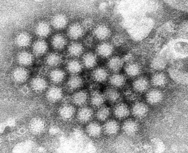 <p>This electron microscope image provided by the Centers for Disease Control and Prevention shows a cluster of norovirus virions</p>