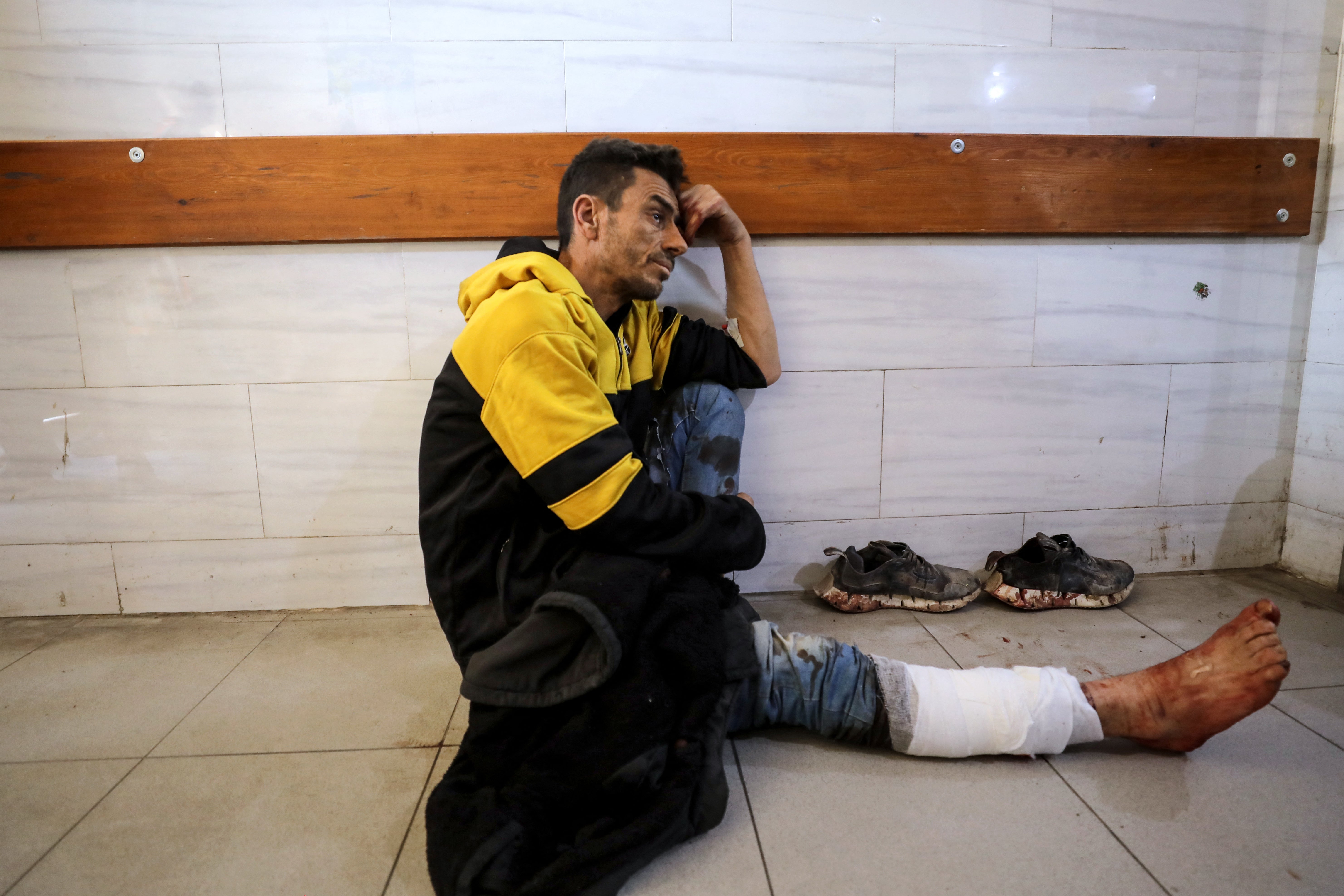 A Palestinian man receives medical care at Kamal Adwan Hospital in Beit Lahia, in the northern Gaza Strip in the wake of Thursday’s incident