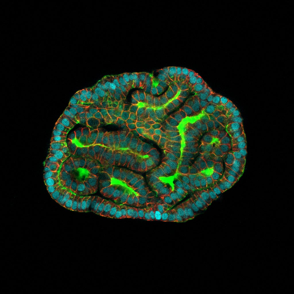 Kidney amniotic fluid organoids resembling renal tubules, as ‘mini organs’ have been grown for the first time using human stem cells