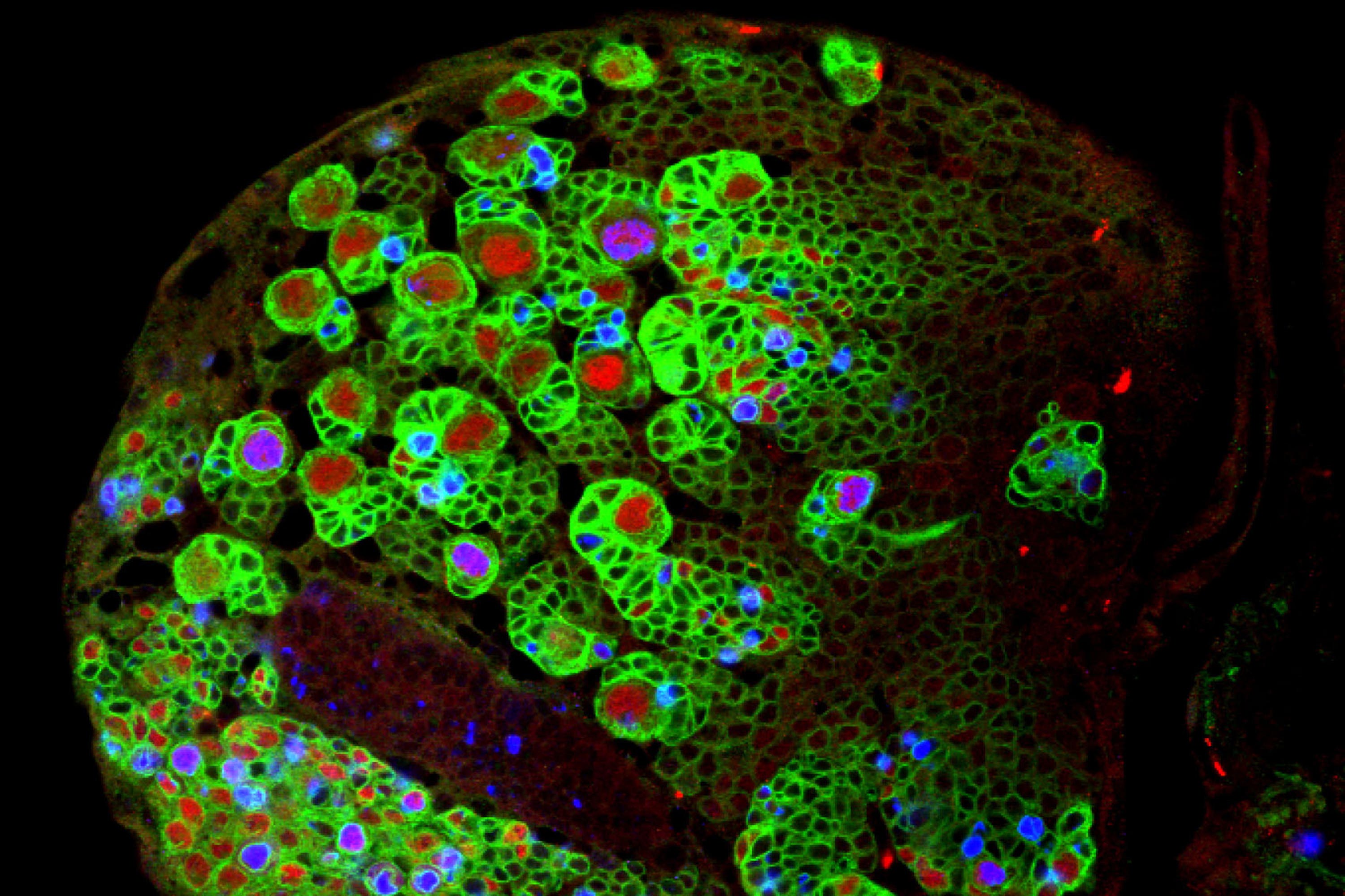 Research of fruit fly brain cells (large cells in red and blue) (Brain Tumour Research/PA)