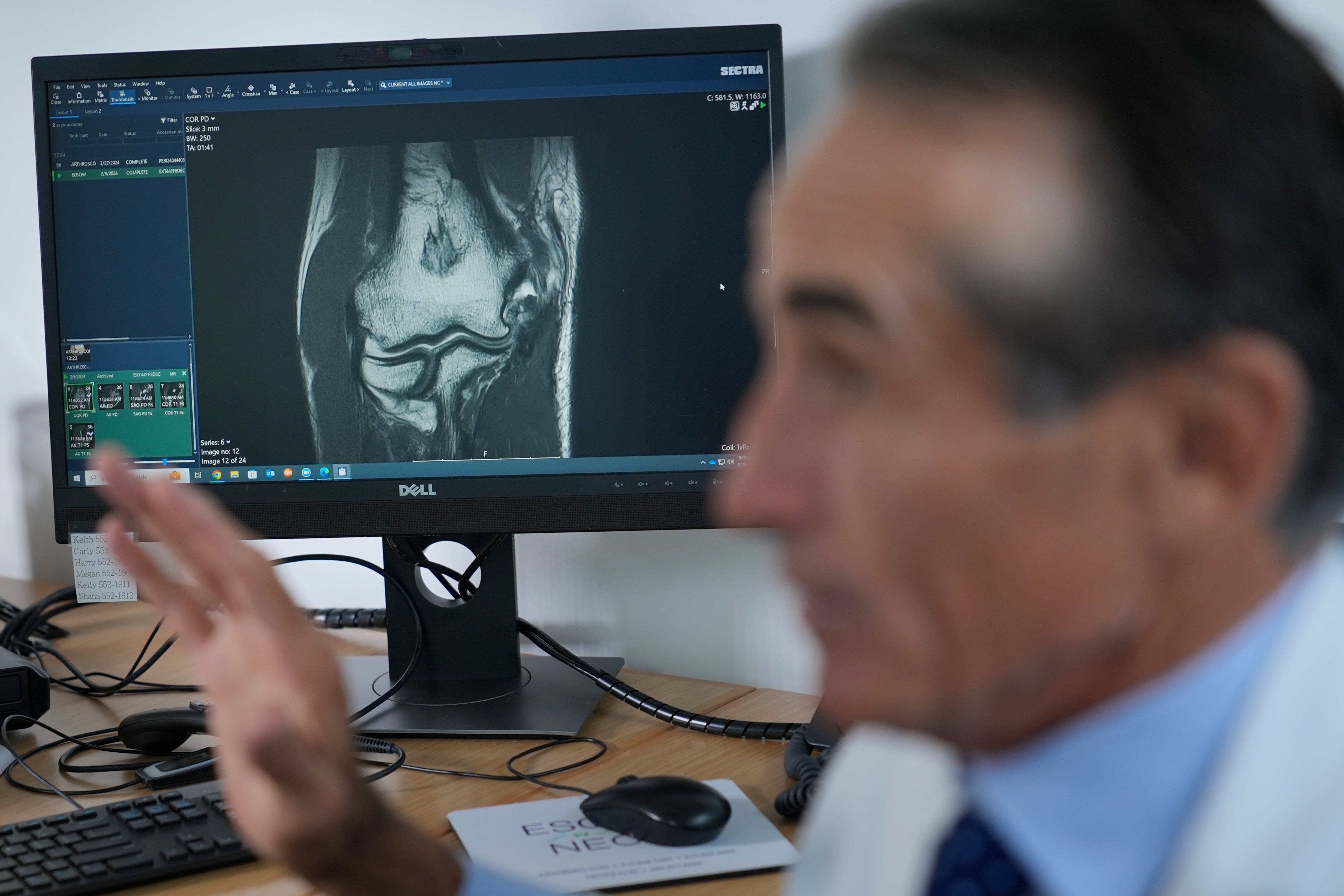 Tommy John Surgery Anniversary Future