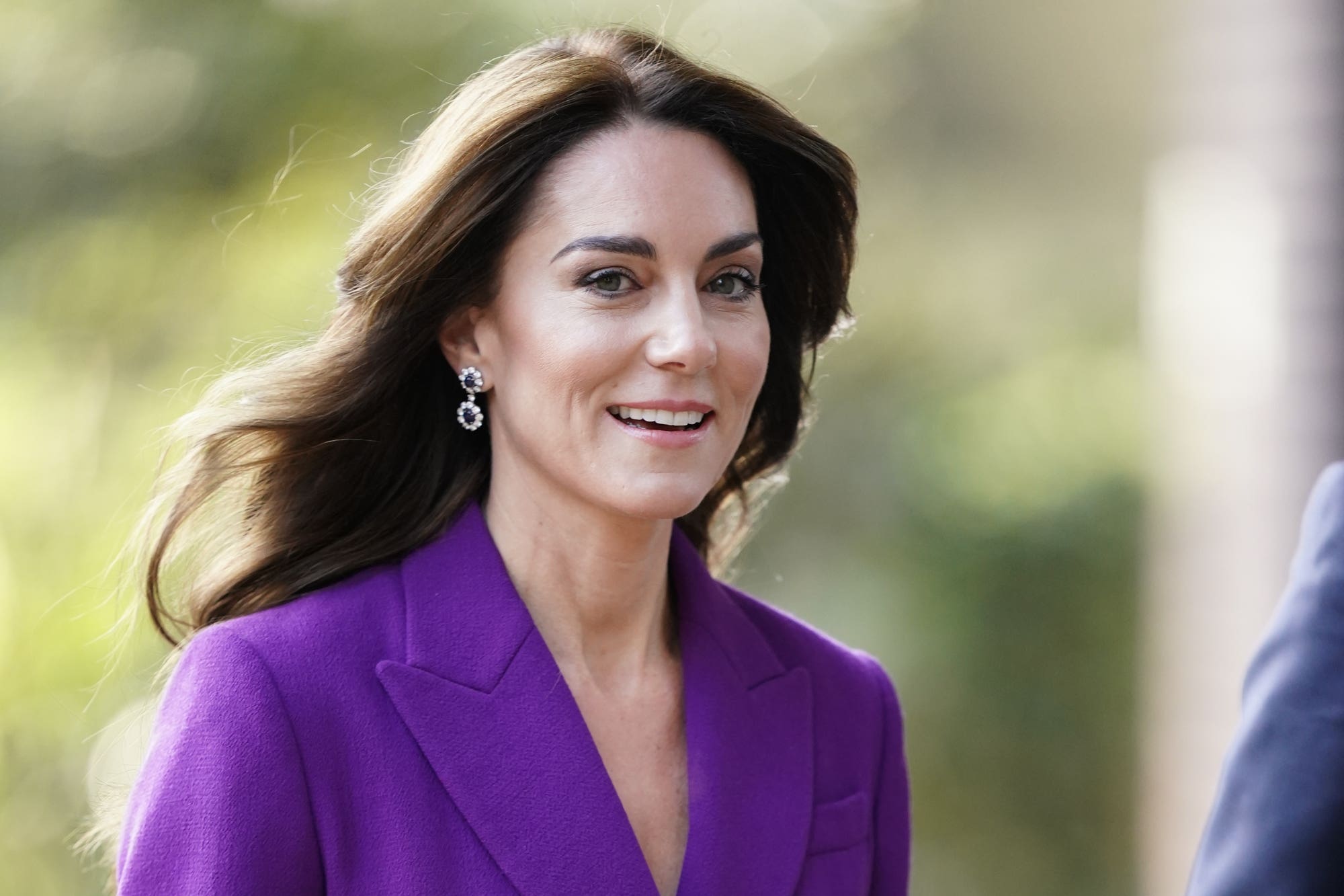 Details of Kate’s surgery have been kept private (Aaron Chown/PA)