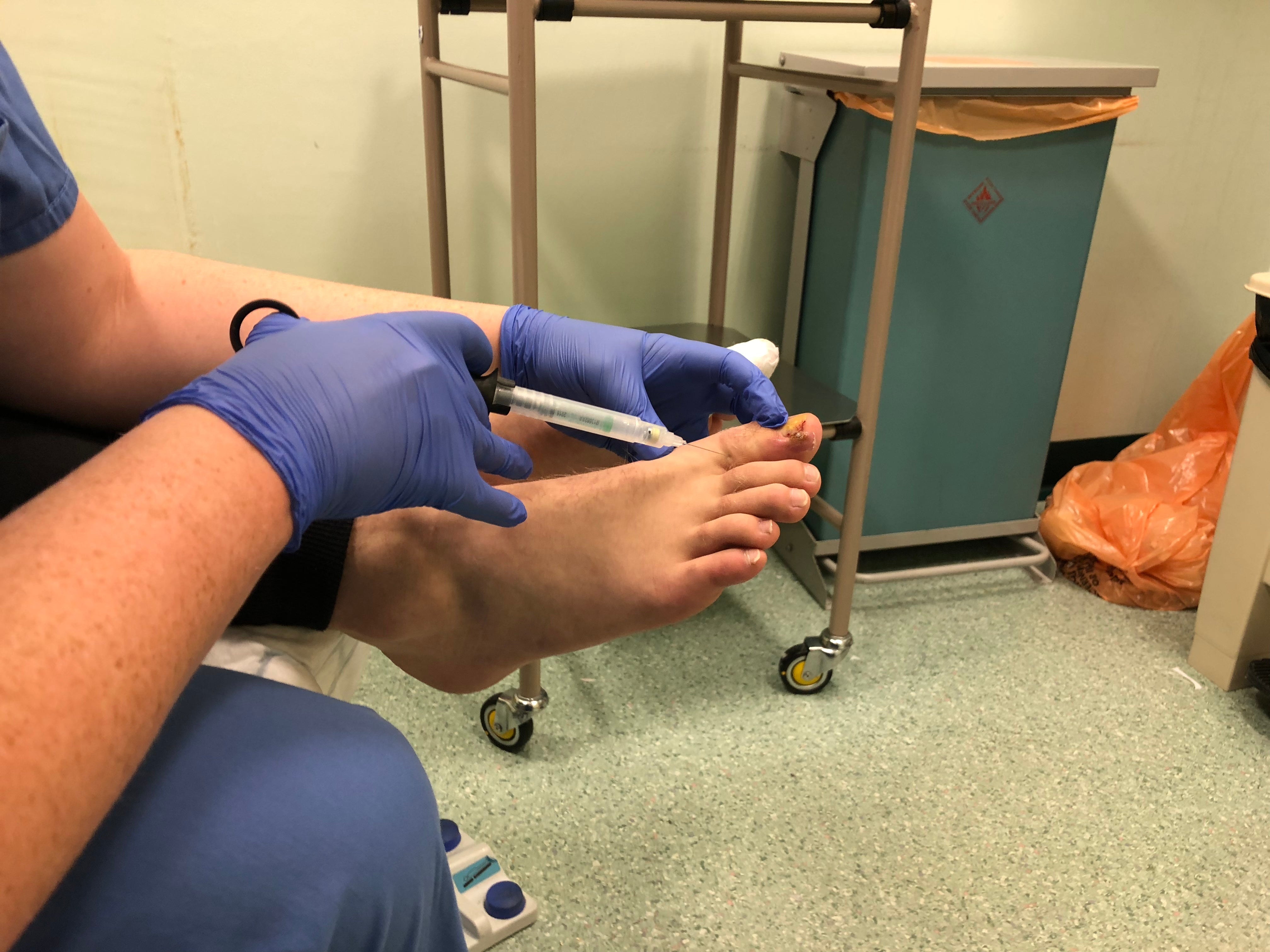 Dominic had a procedure to remove two toenails (Collect/PA Real Life)