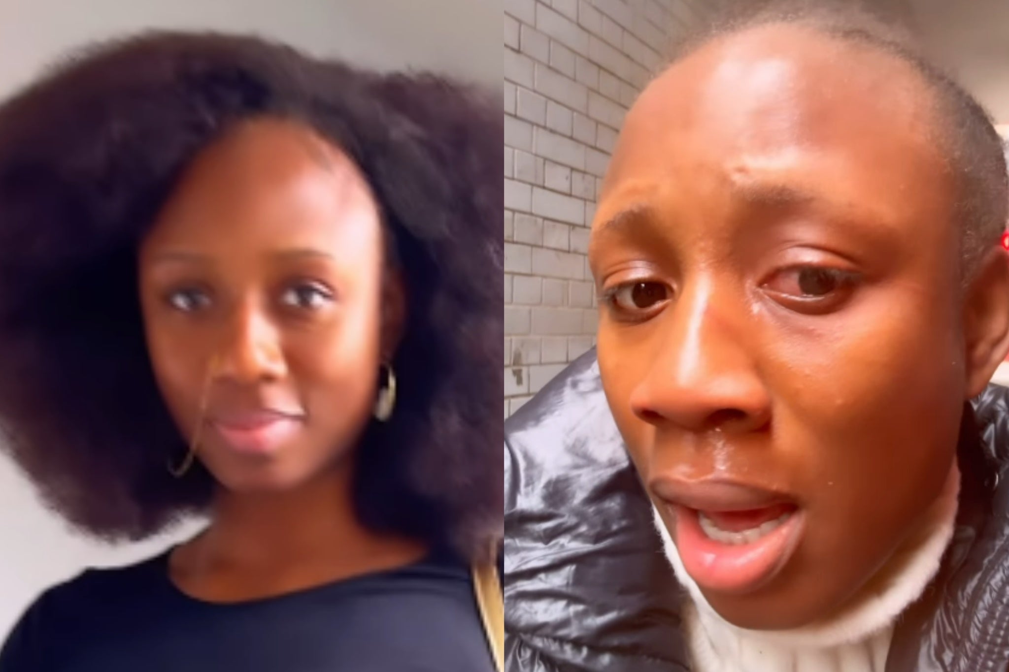 Dancer Korra Obidi suffered an ‘acid attack’ in London