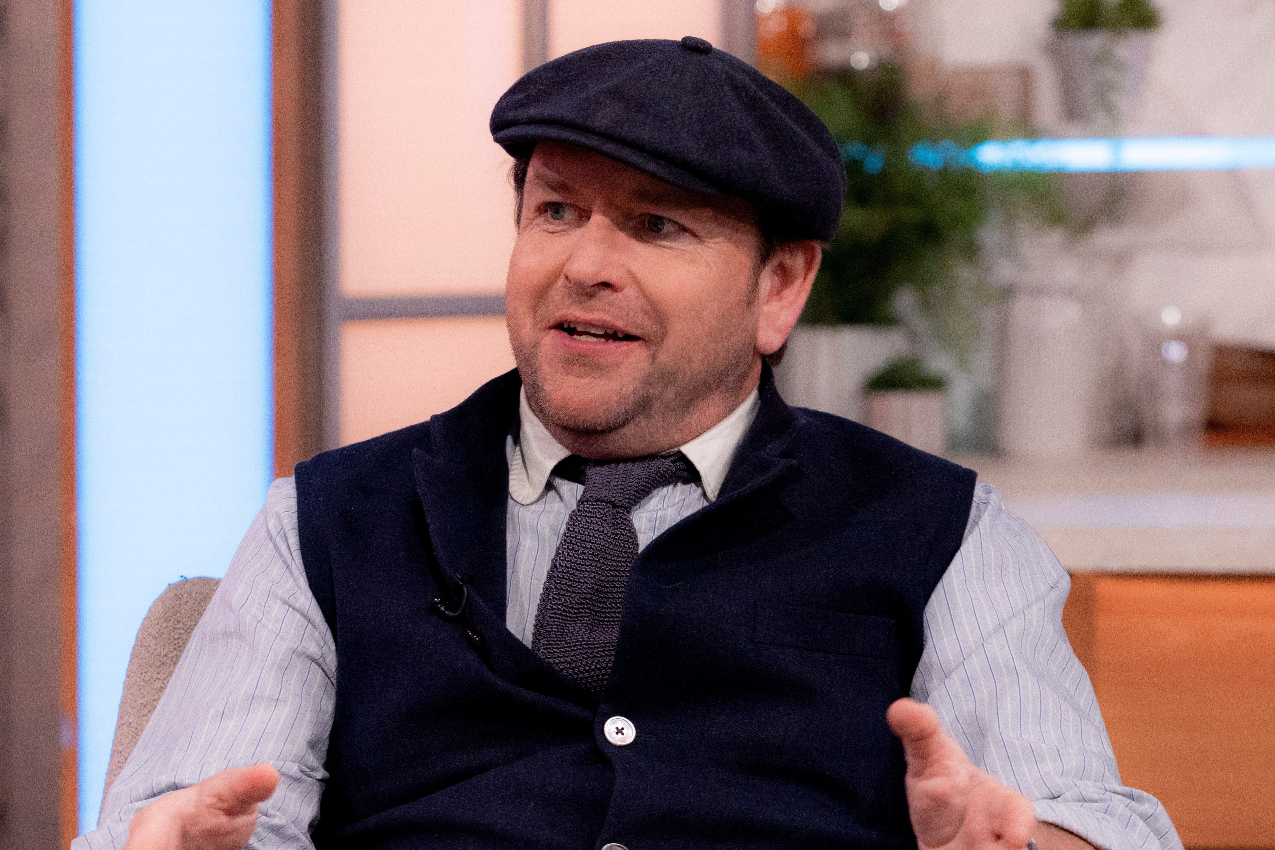 James Martin told Lorraine Kelly the stitches from his facial surgery had fallen out