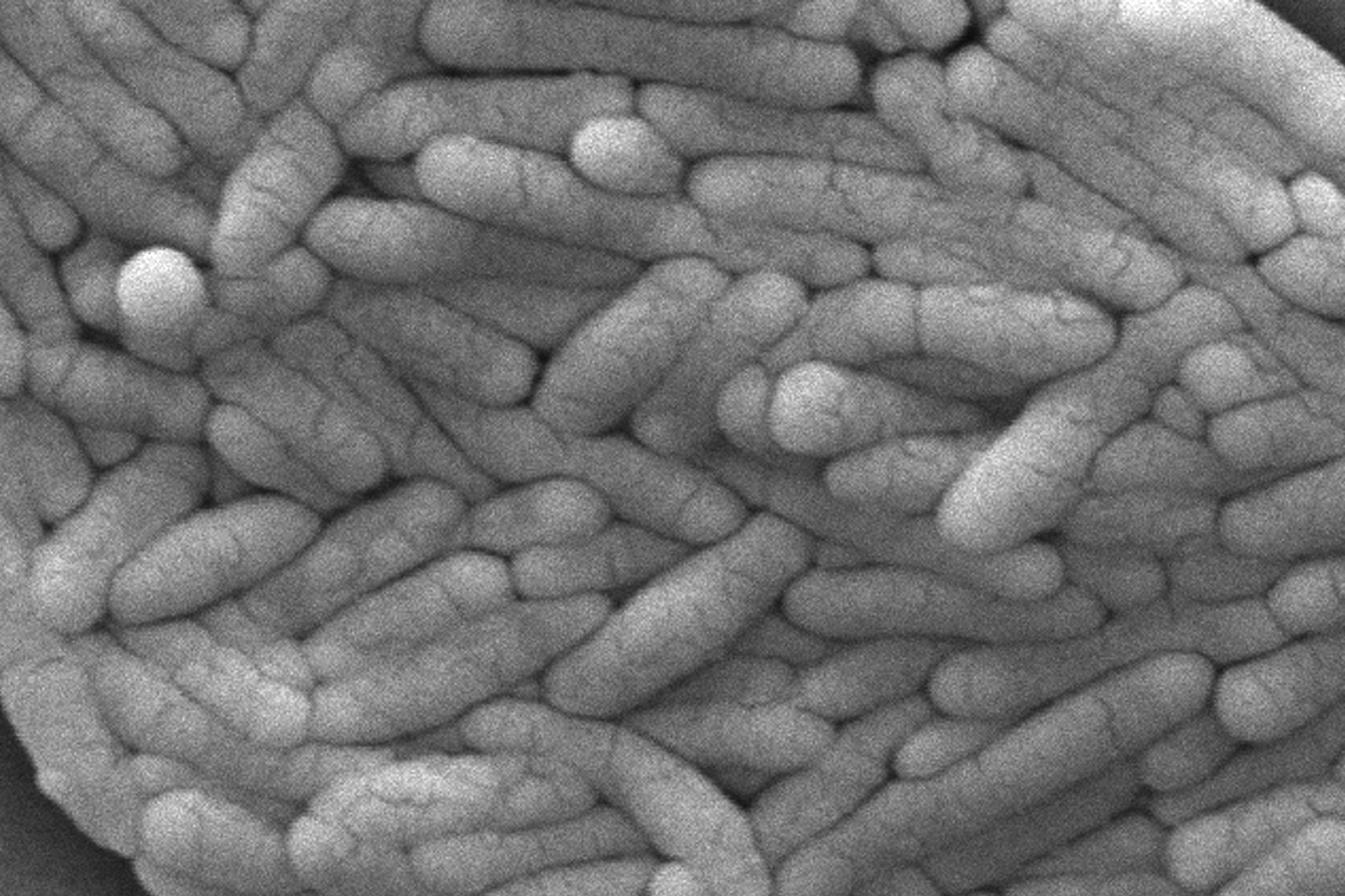 Researchers believe that salmonella could be further engineered to work alongside the immune system