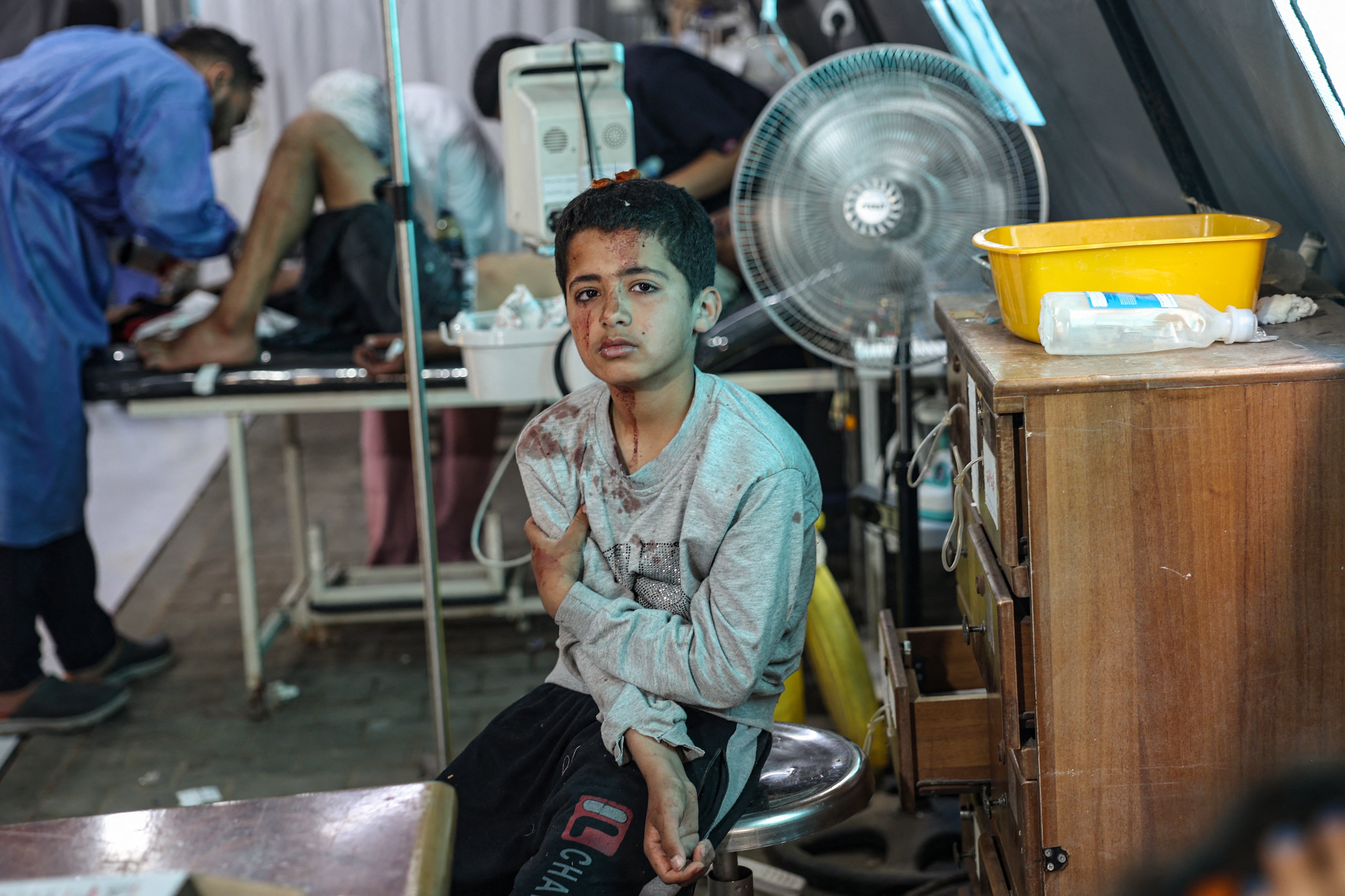 An injured Palestinian boy awaits treatment at the Kuwaiti hospital following Israeli strikes in Rafah in the southern Gaza Strip