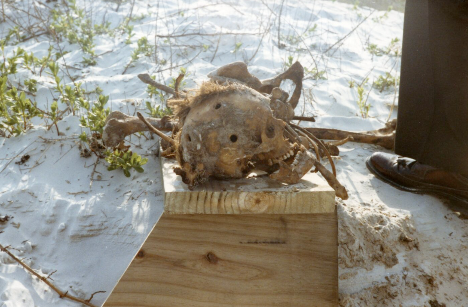 Mary Pultz’s remains were examined by medical examiner Dr. Wendolyn Sneed who found she had suffered multiple injuries. There were also three surgical burr holes drilled into her skull