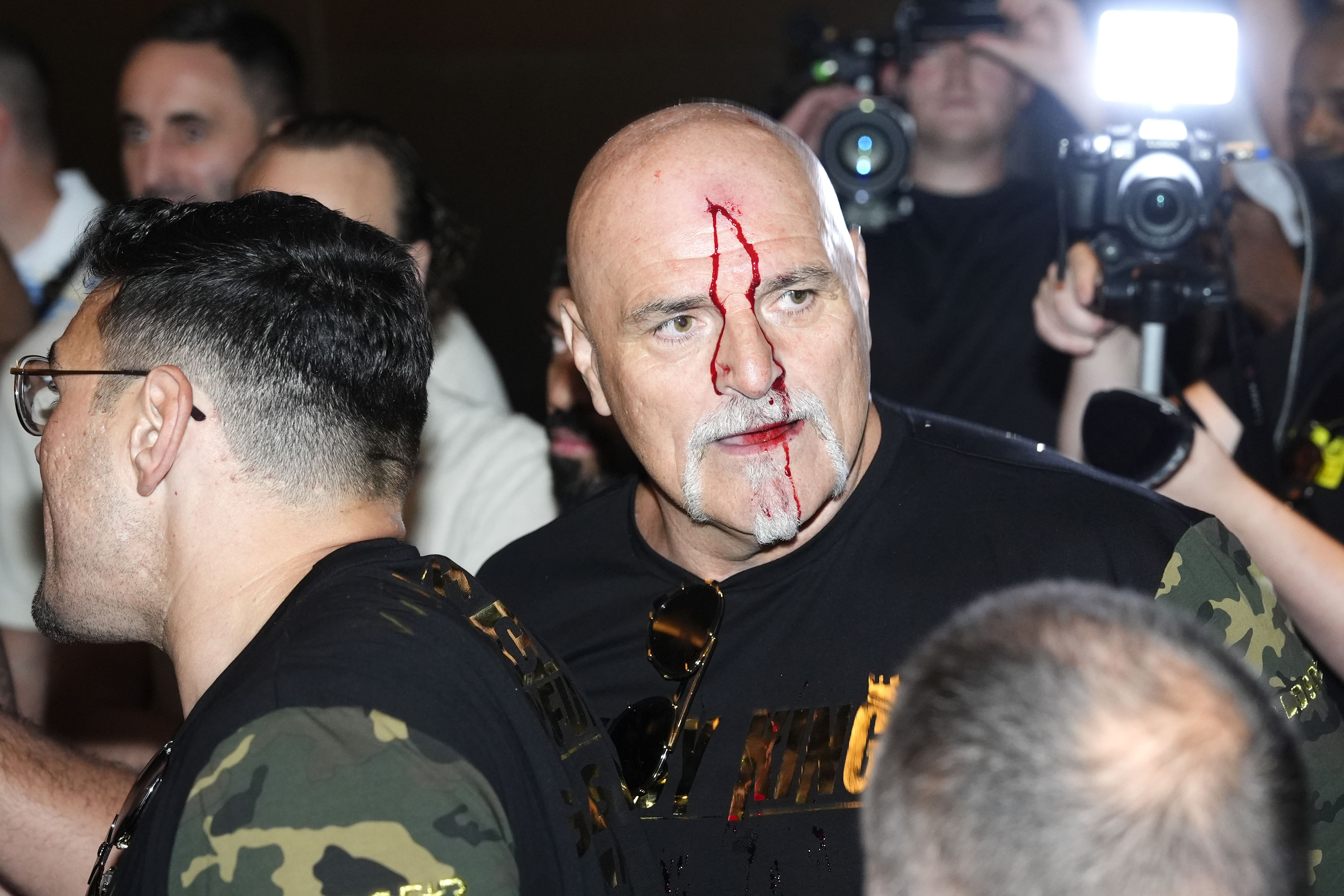 John Fury sustained a cut and the rival camps had to be separated