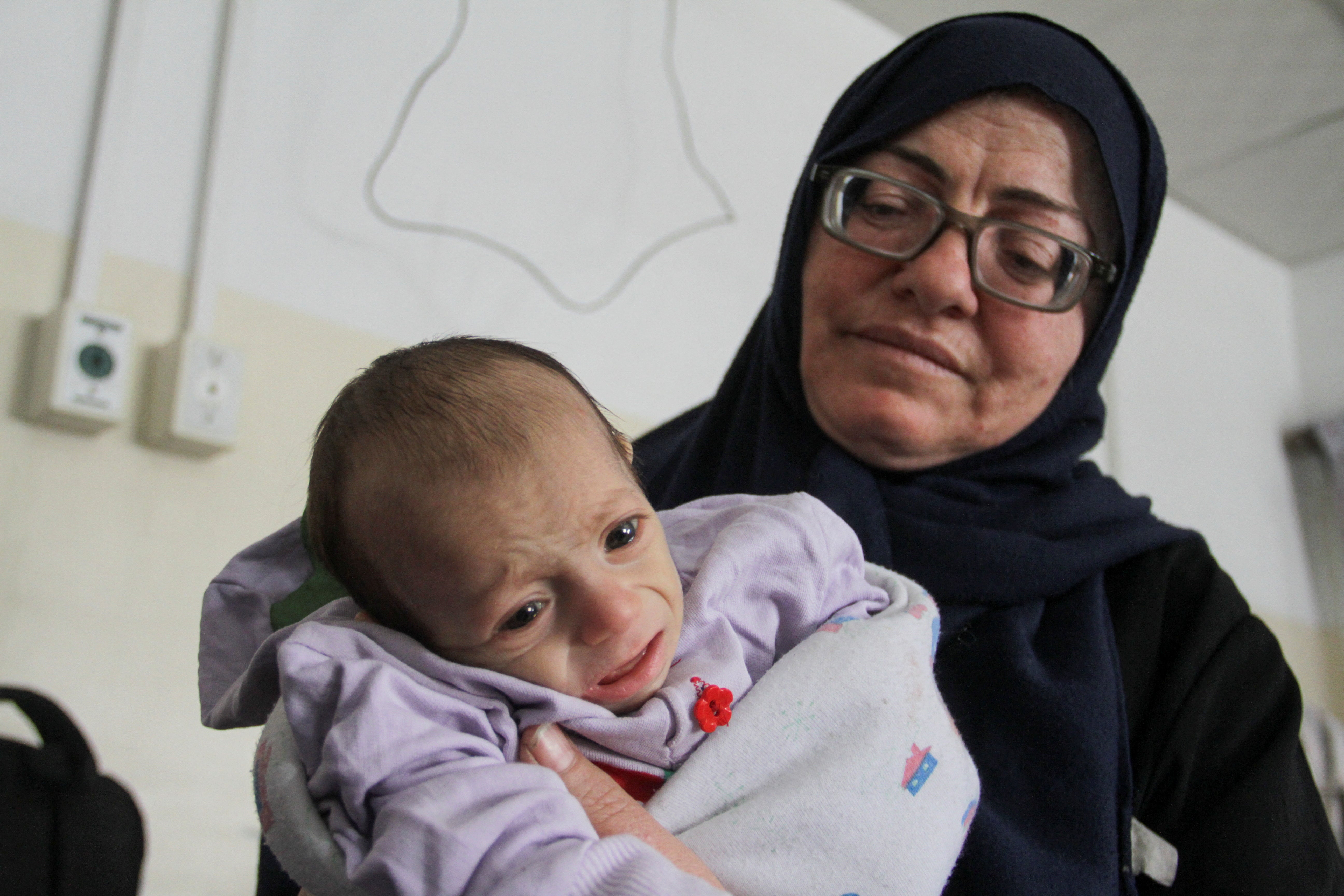 A Palestinian child, who is suffering from malnutrition, receives healthcare at Kamal Adwan Hospital in northern Gaza Strip in April, amid widespread hunger, during the ongoing conflict between Israel and Hamas