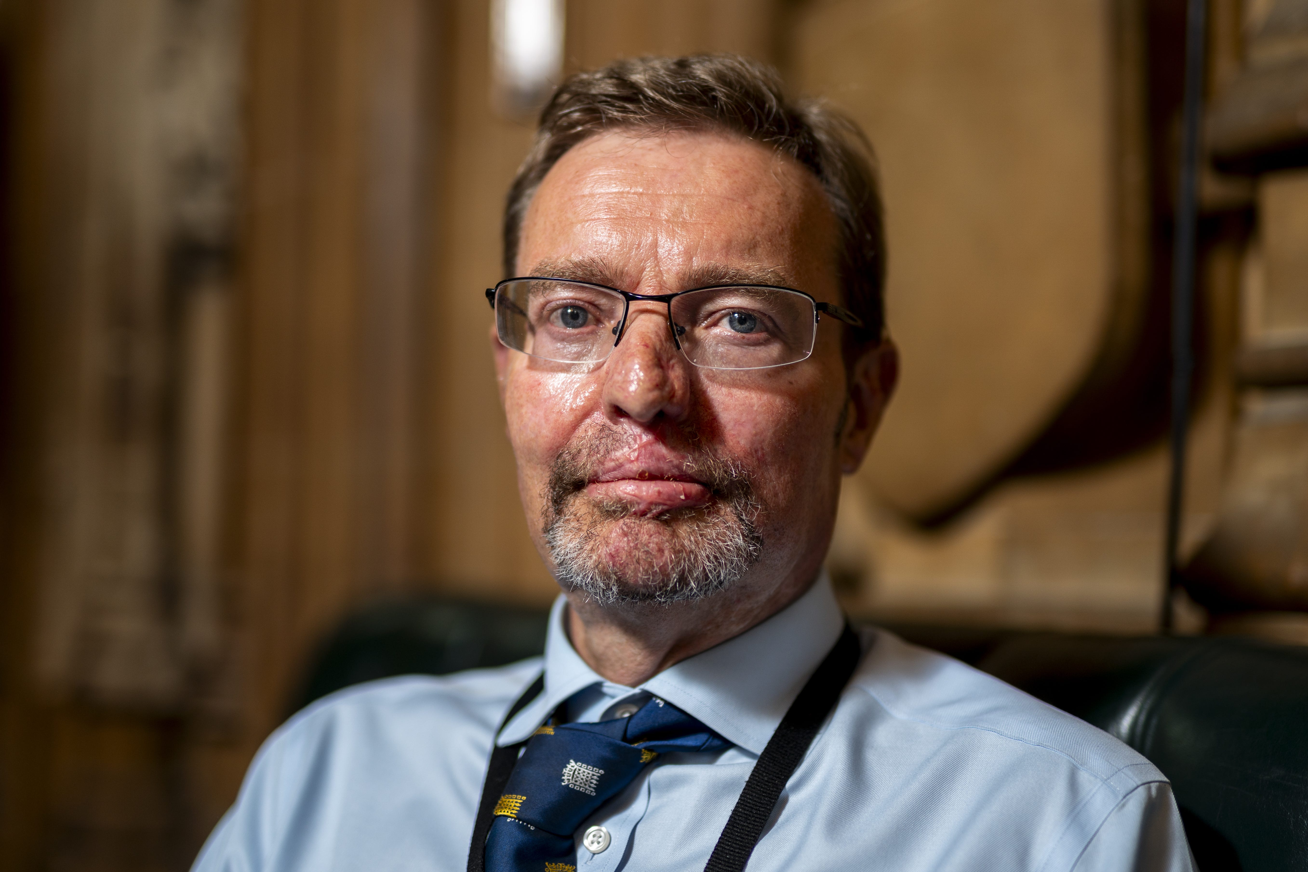 Craig Mackinlay, Conservative MP for South Thanet, poses for a portrait in the Central Lobby of the Palace of Westminster after he returned to the House of Commons for the first time since he was rushed into hospital with sepsis (Jordan Pettit//PA)