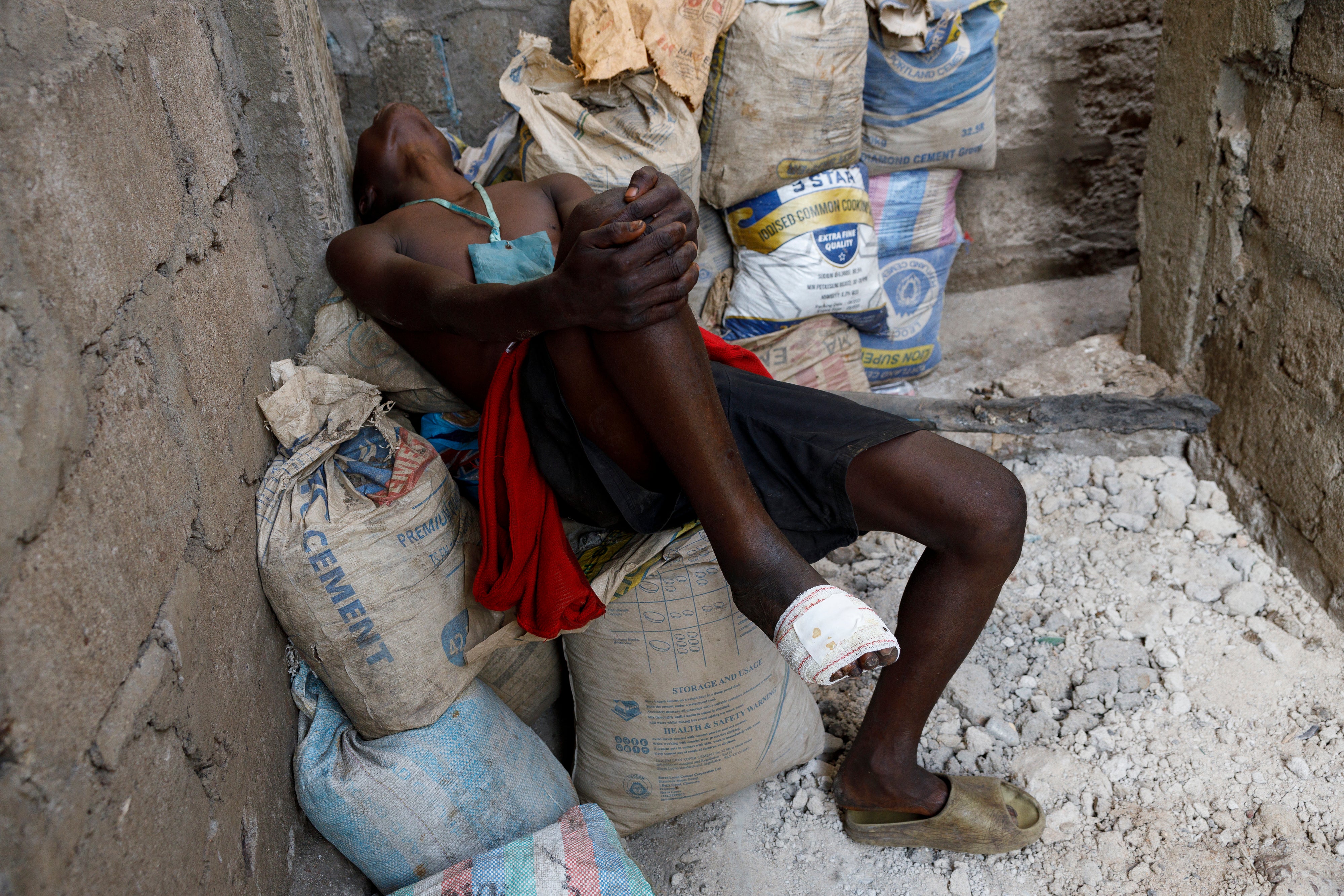 A Kush user reacts after receiving treatment at Sierra Leone’s Youth Development and Child Link