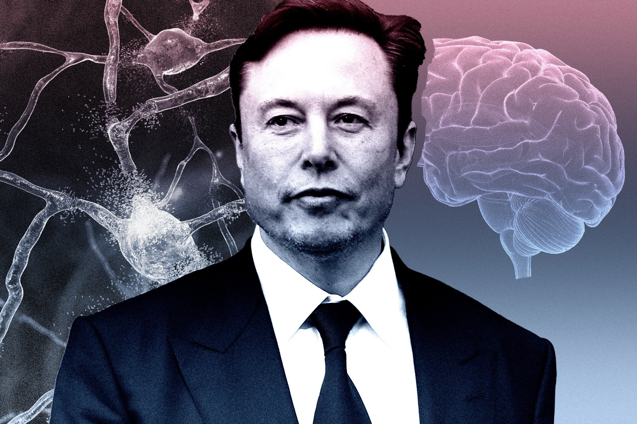 Neuralink, Elon Musk’s company, carried out the life-changing surgery