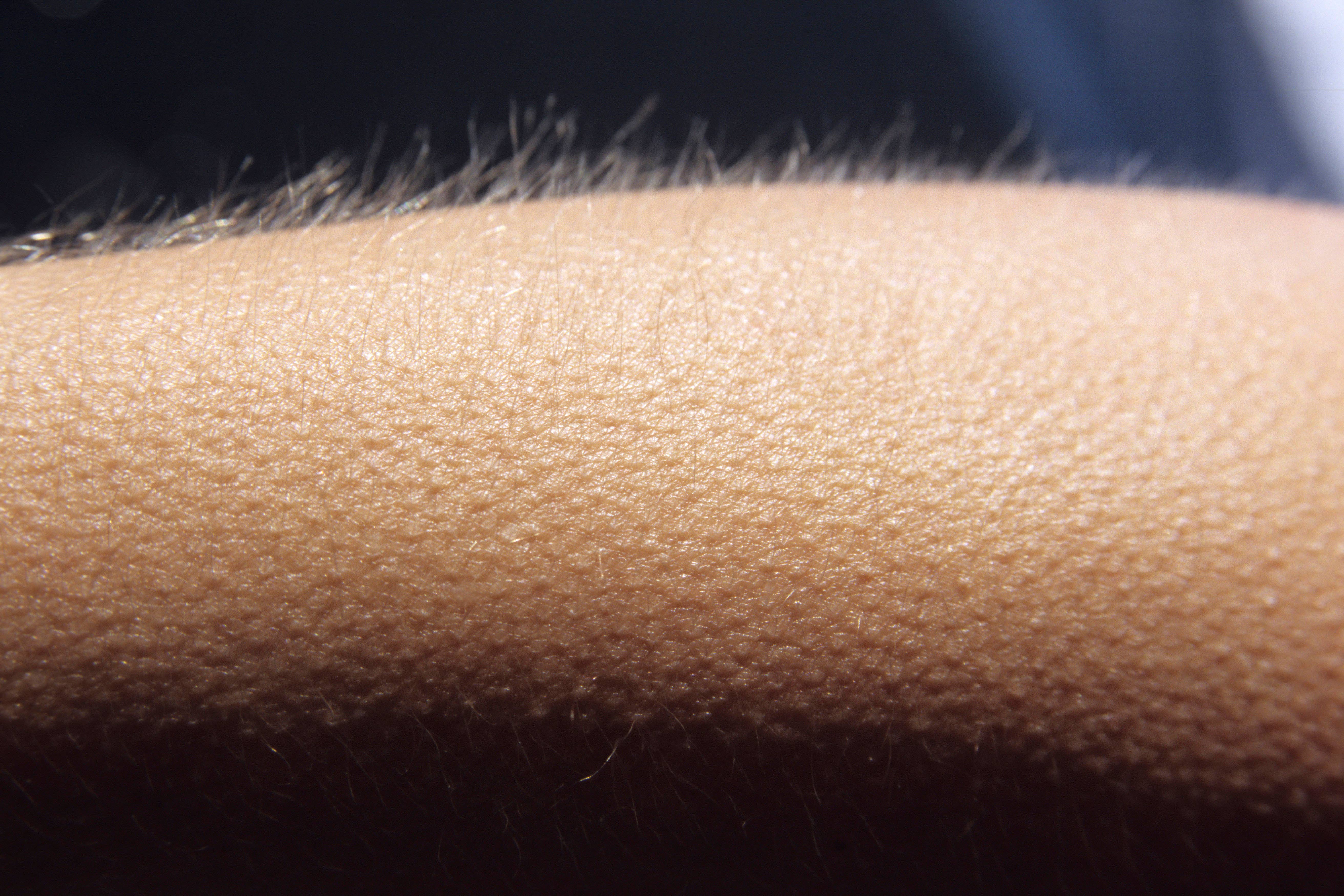 Goosebumps (Alamy/PA)