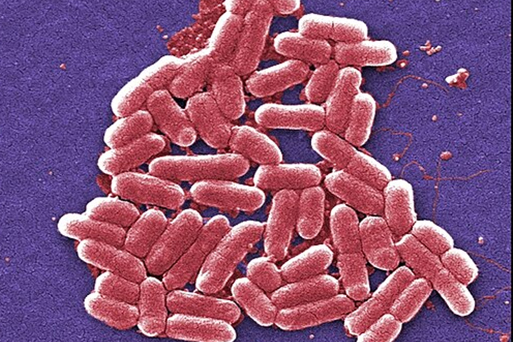 Some E.coli strains cause severe illness