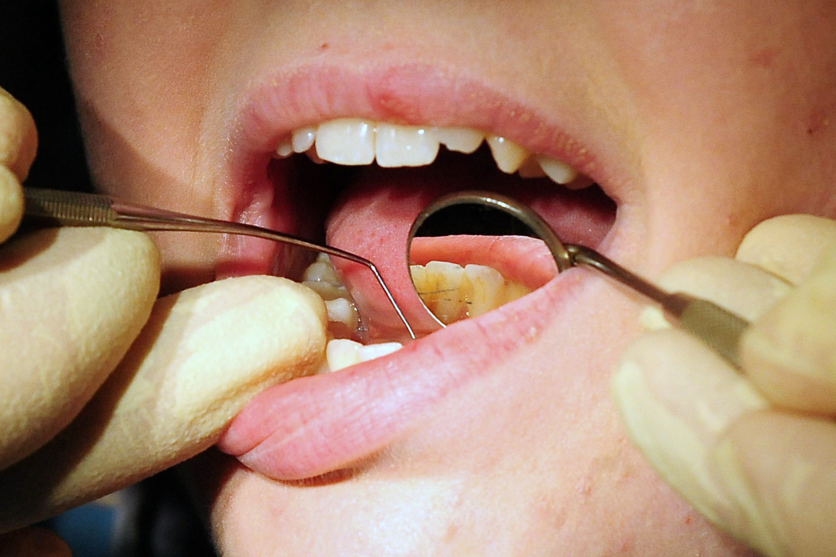 Labour wants to clear a dental treatment backlog (PA)