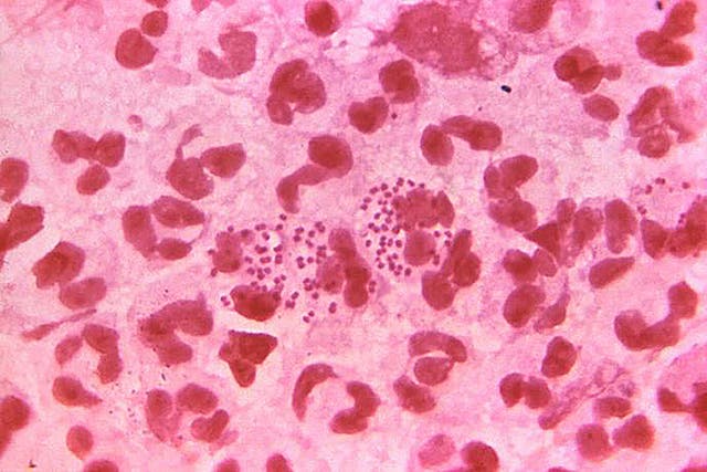 <p>A world-first gonorrhoea vaccine programme will be launched in England</p>