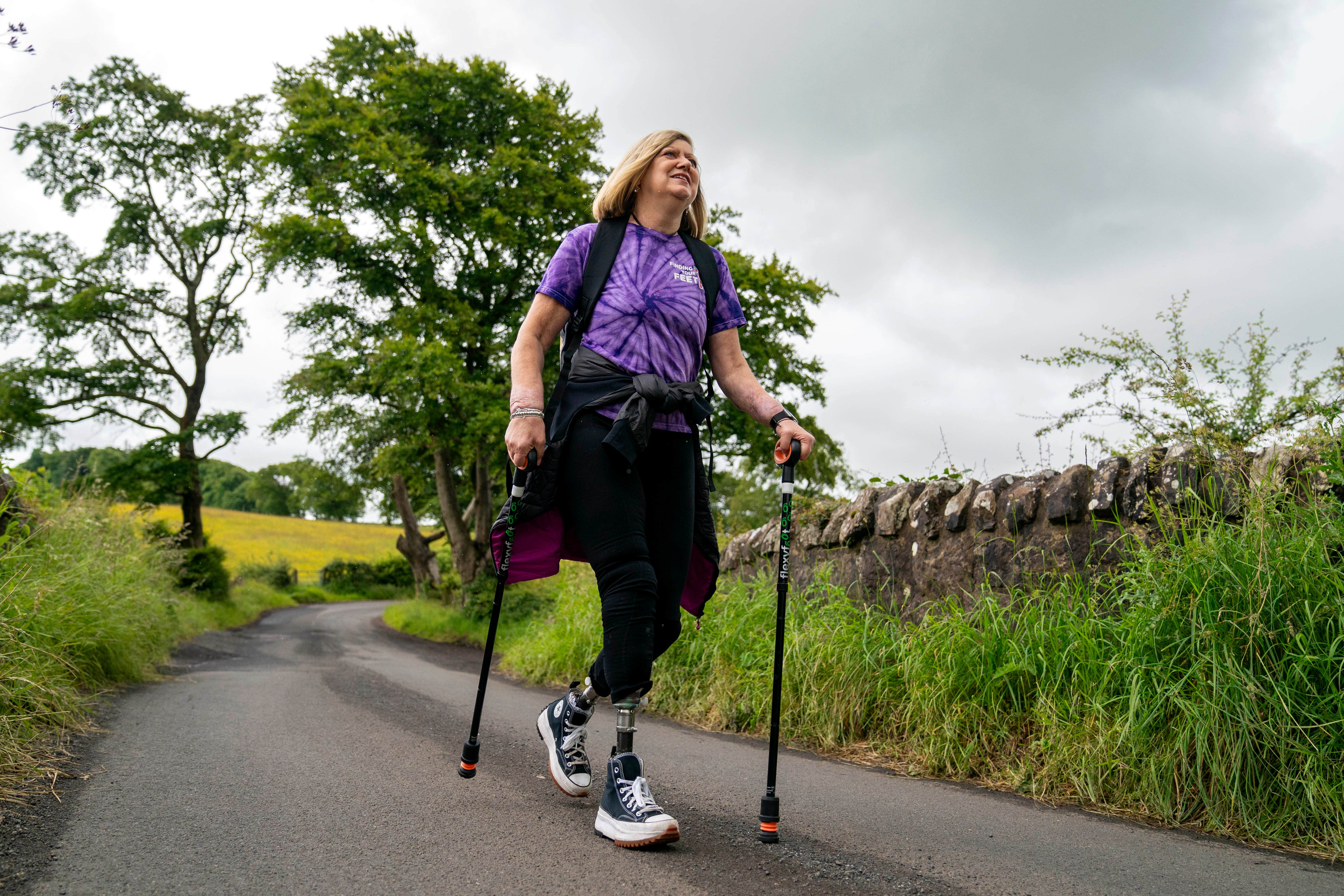 Quadruple amputee Cor Hutton is taking on the 26-mile Inca Trail in the Peruvian Andes to raise money for the Finding Your Feet amputee charity, which she set up in 2014 (Jane Barlow/PA Wire)