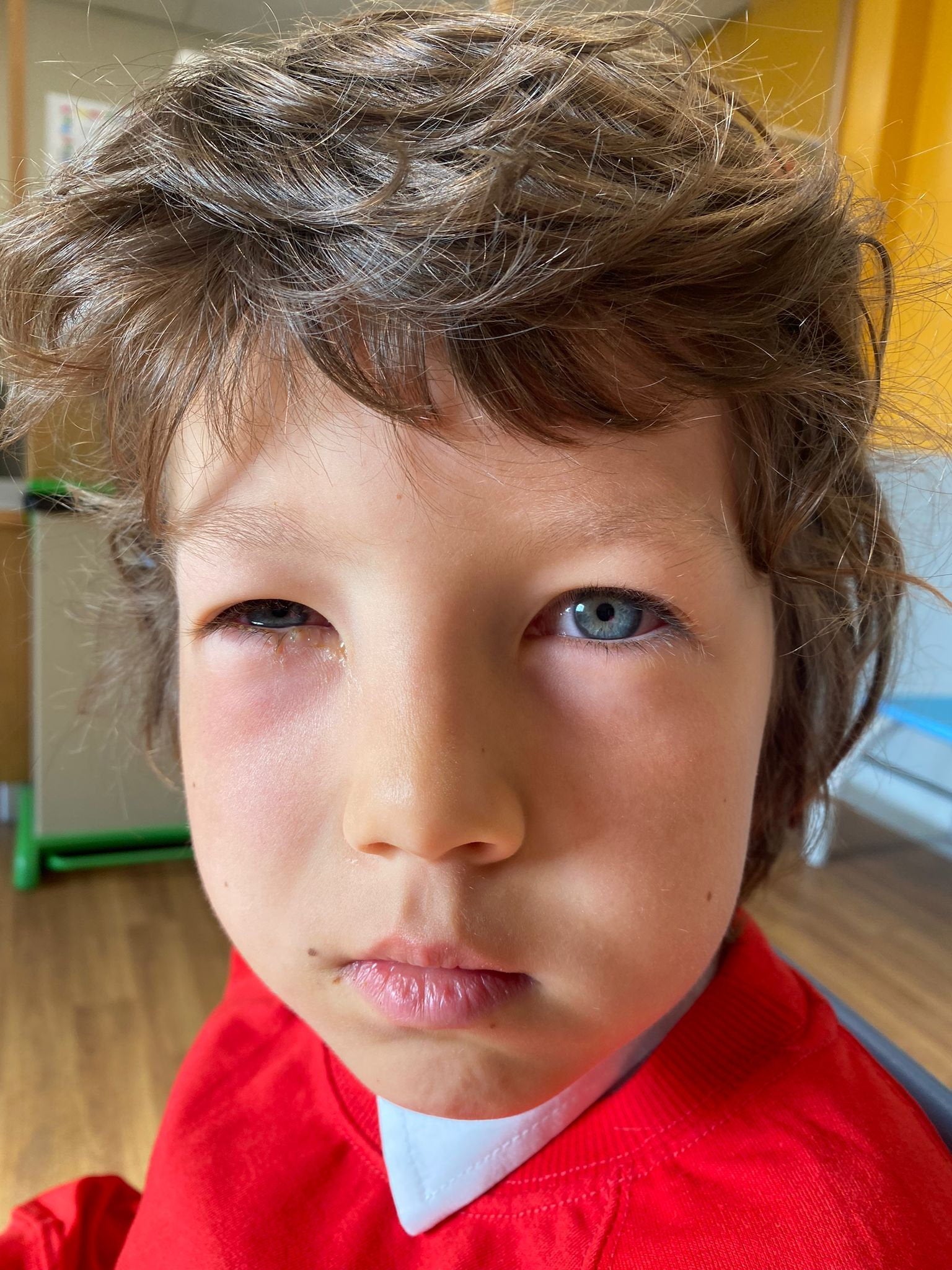 Lawrence after he was gassed by police after being caught in a pro-Palestine protest in Paris