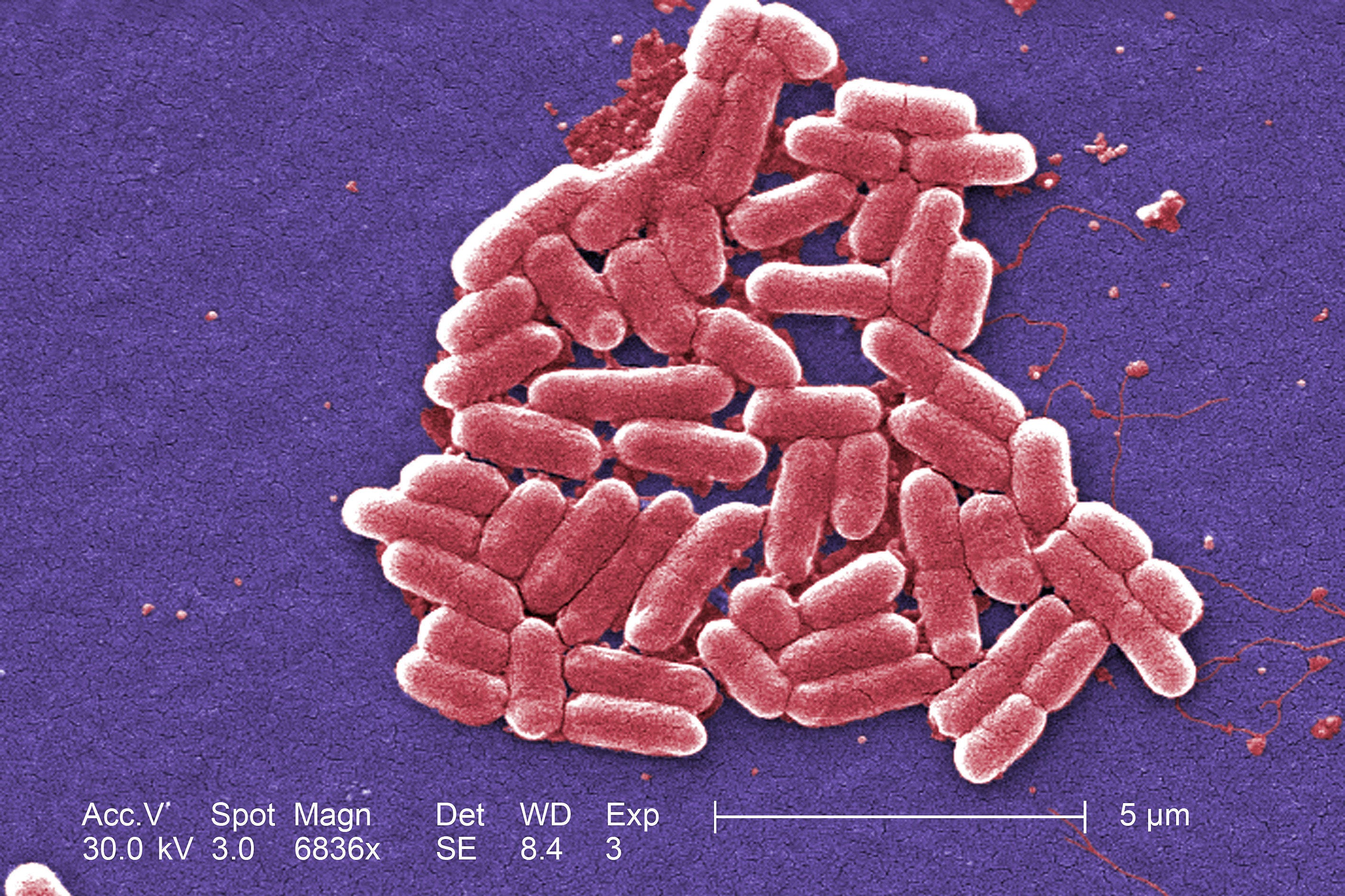 More than 80 people have been admitted to hospital as a result of an E. coli outbreak linked to lettuce, with many retailers recalling sandwiches, wraps, salads and rolls over fears they may also be linked (PA)