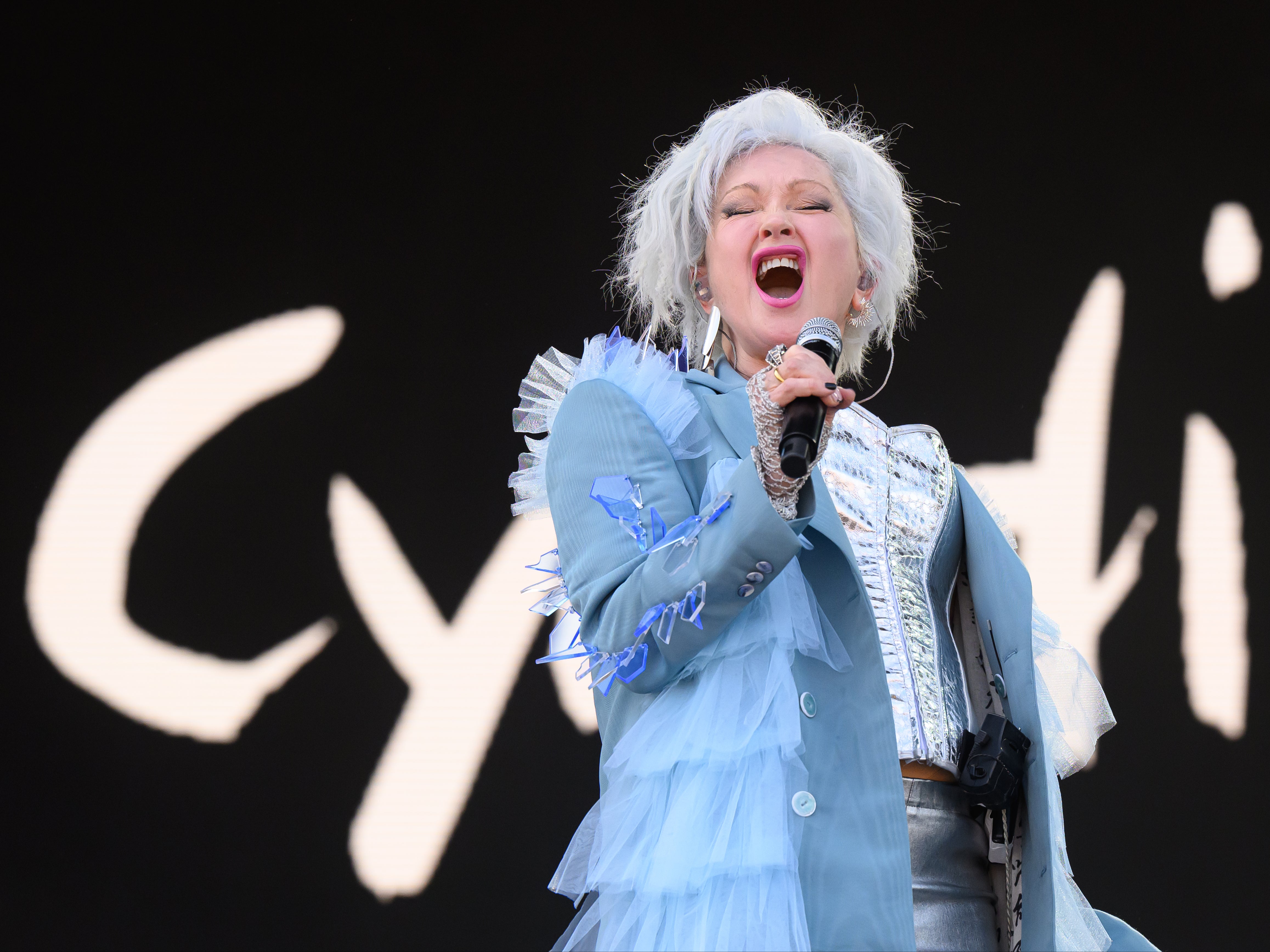 Cyndi Lauper worked restaurant and retail jobs to make money before she was a successful singer