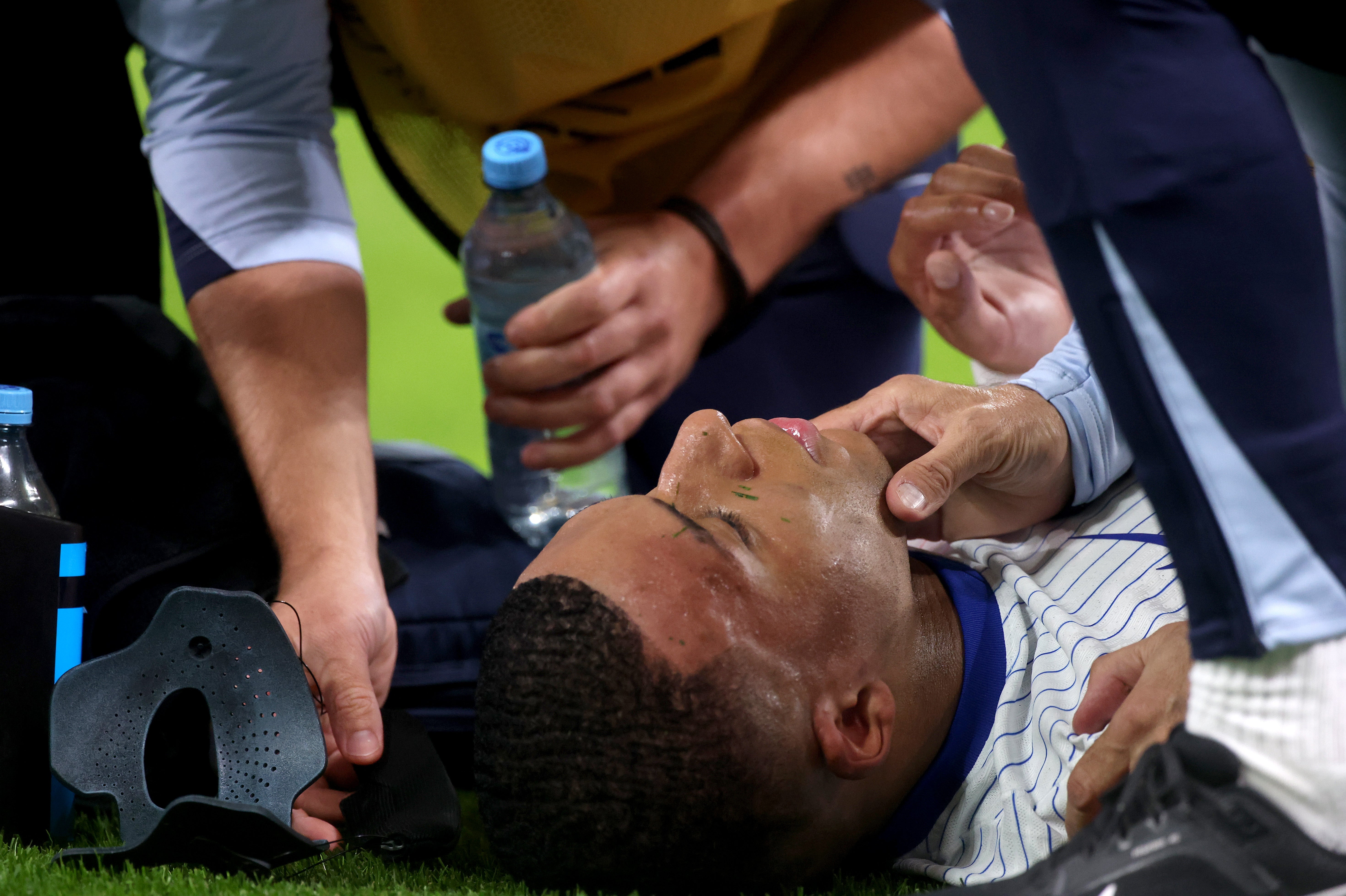 Kylian Mbappe’s face is inspected after his mask was struck with the ball