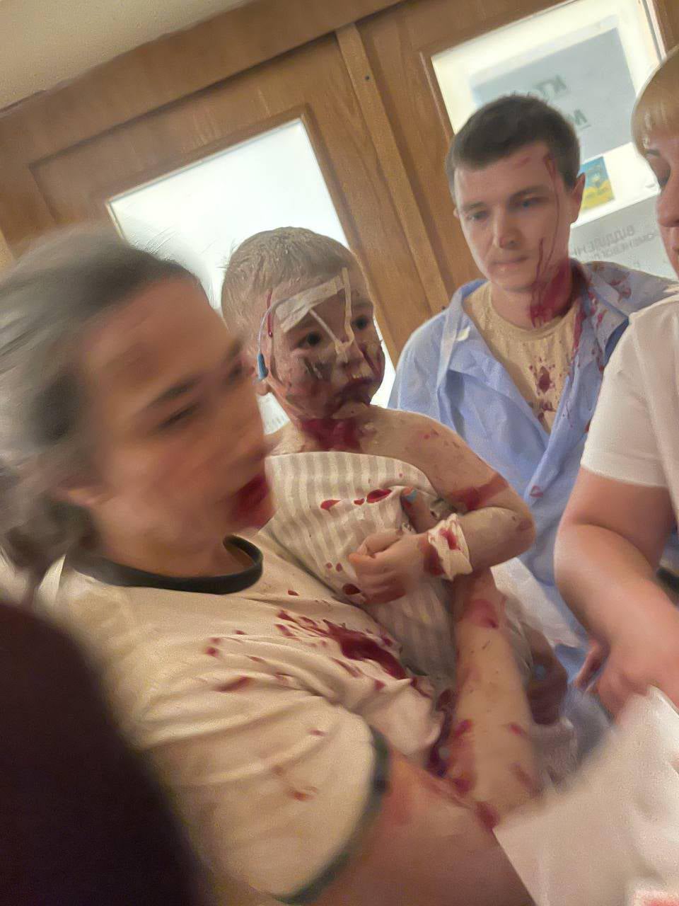 An adviser to Volodymyr Zelensky shared this image of a child caught up in the horror