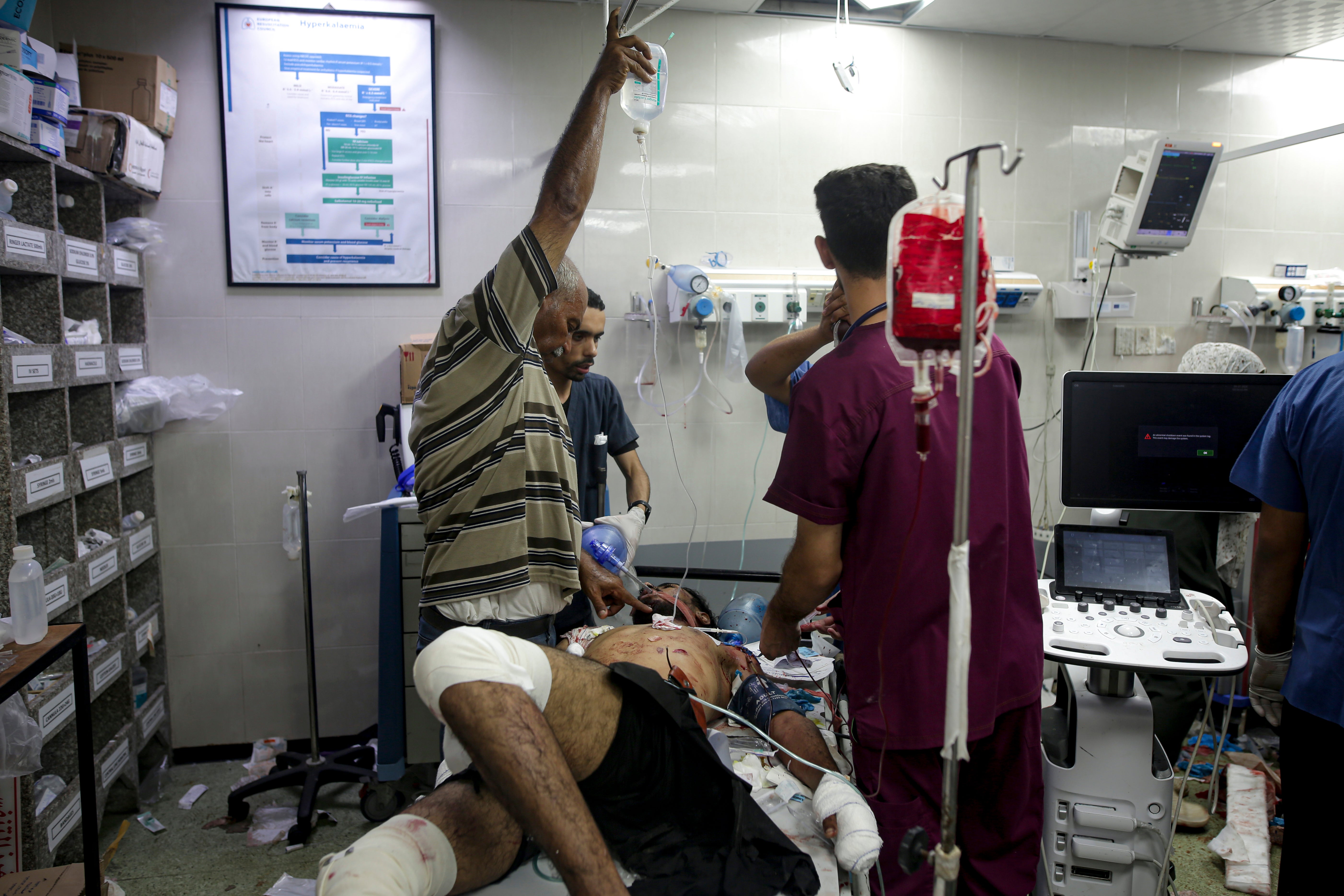 A Palestinian man wounded in the Israeli bombardment of the Gaza Strip is treated in a hospital in Khan Younis