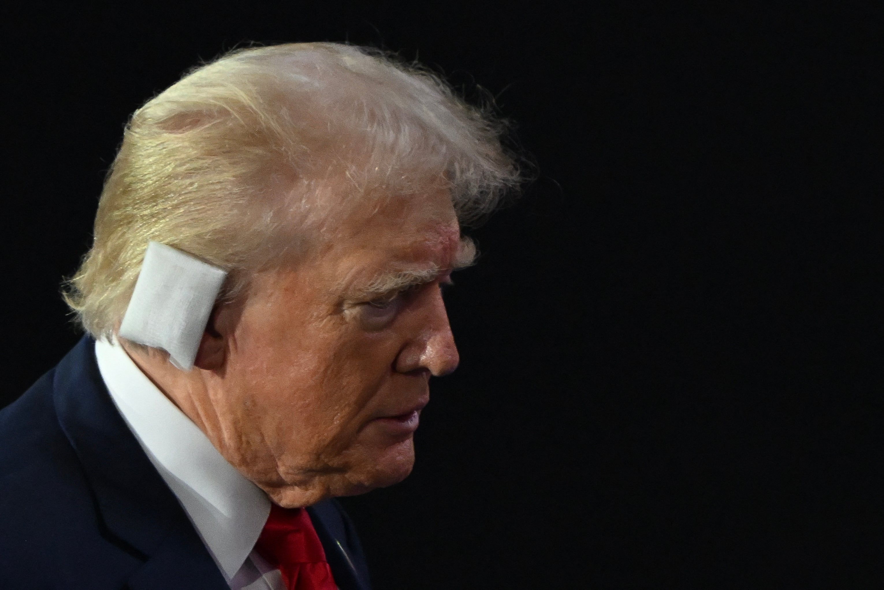 A bandage covers the spot where a bullet ‘pierced’ Donald Trump’s right ear when a gunman opened fire into a campaign rally on July 13. The former president made his first public appearance since the assassination attempt at the Republican National Convention two days later.