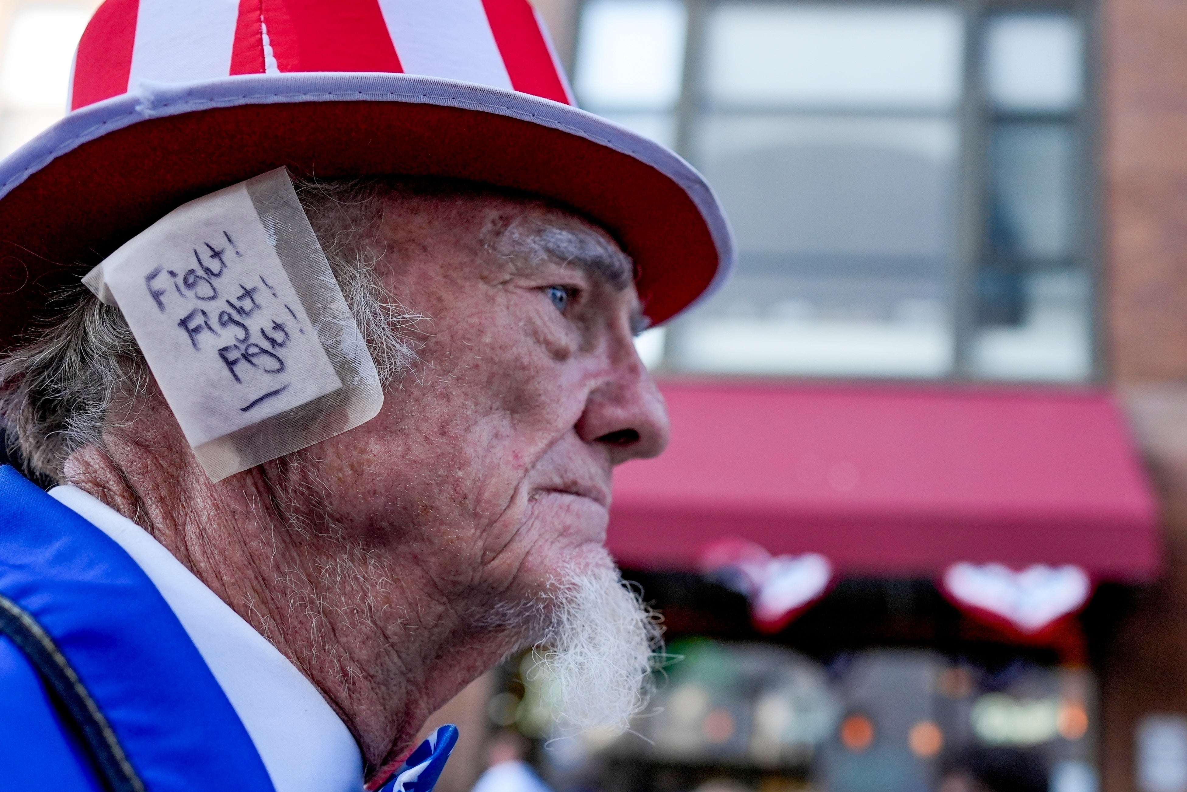 Trump’s bandaged ear became a fashion statement for Republicans