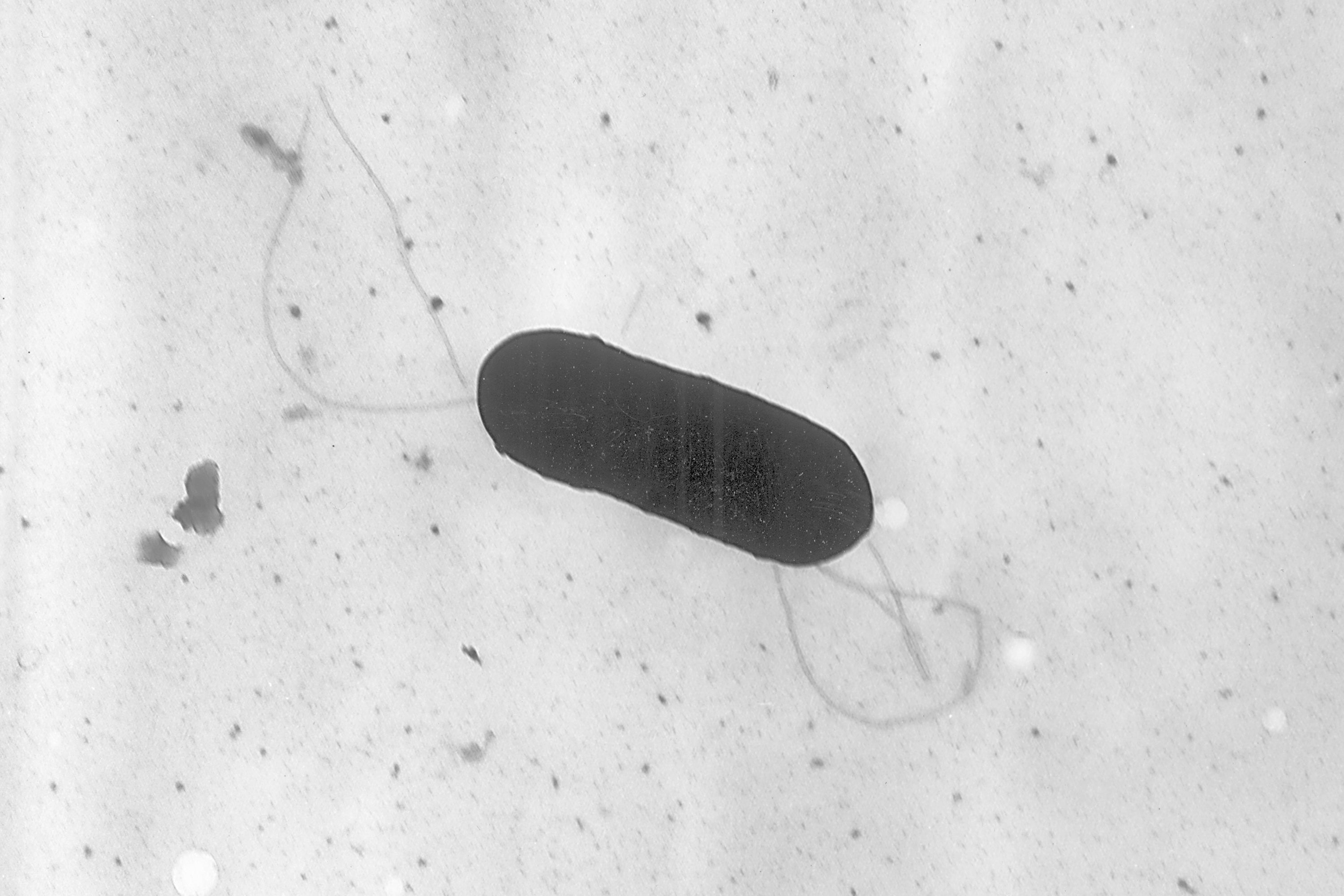 This 2002 electron microscope image made available by the Centers for Disease Control and Prevention shows a Listeria monocytogenes bacterium, responsible for the food borne illness listeriosis