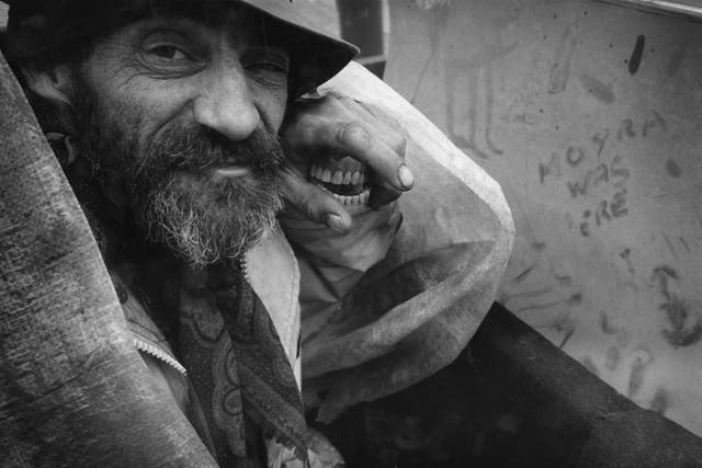 <p>Homeless man Zy with his new set of false teeth</p>