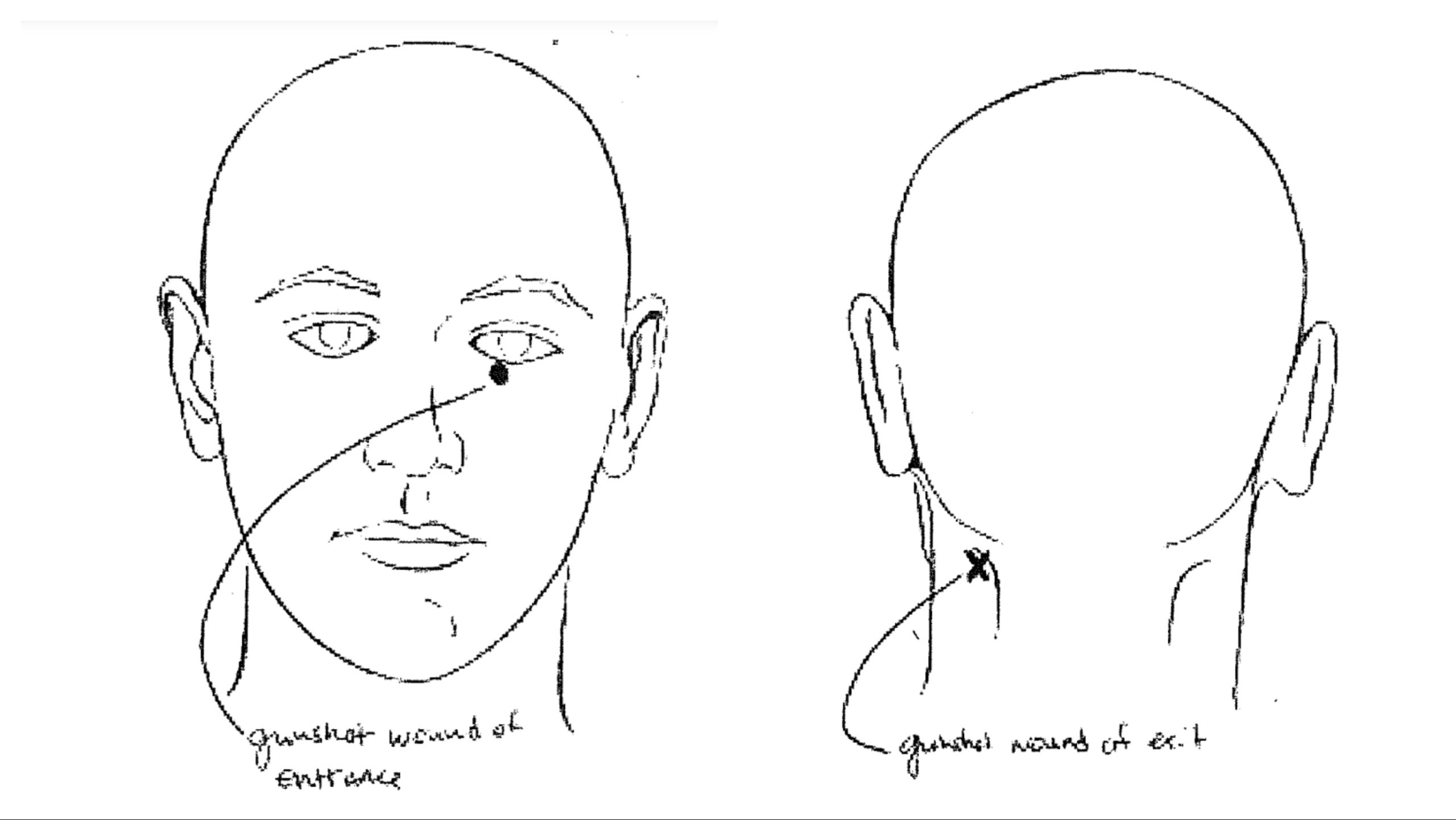 Massey was shot just below the left eye, with the round exiting through the back of her neck in a downward trajectory, according to the Sangamon County Coroner’s Office