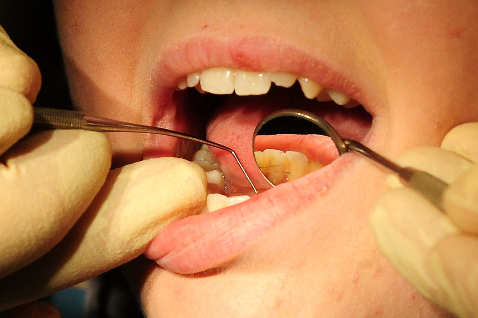 People reported getting dental care in nearly 30 different countries, including France and India (Rui Vieira/PA)