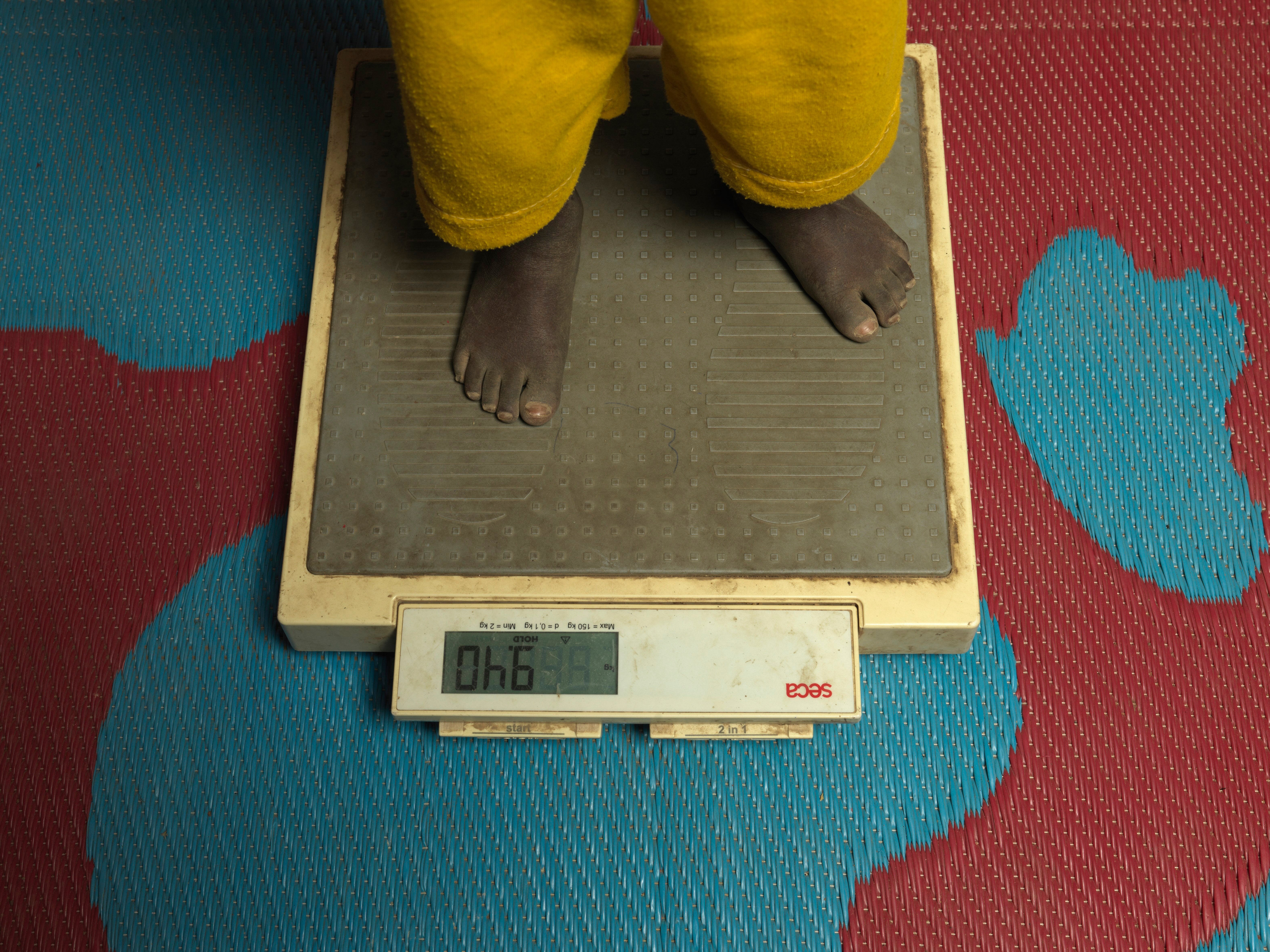 Adheet’s child is weighed during a screening