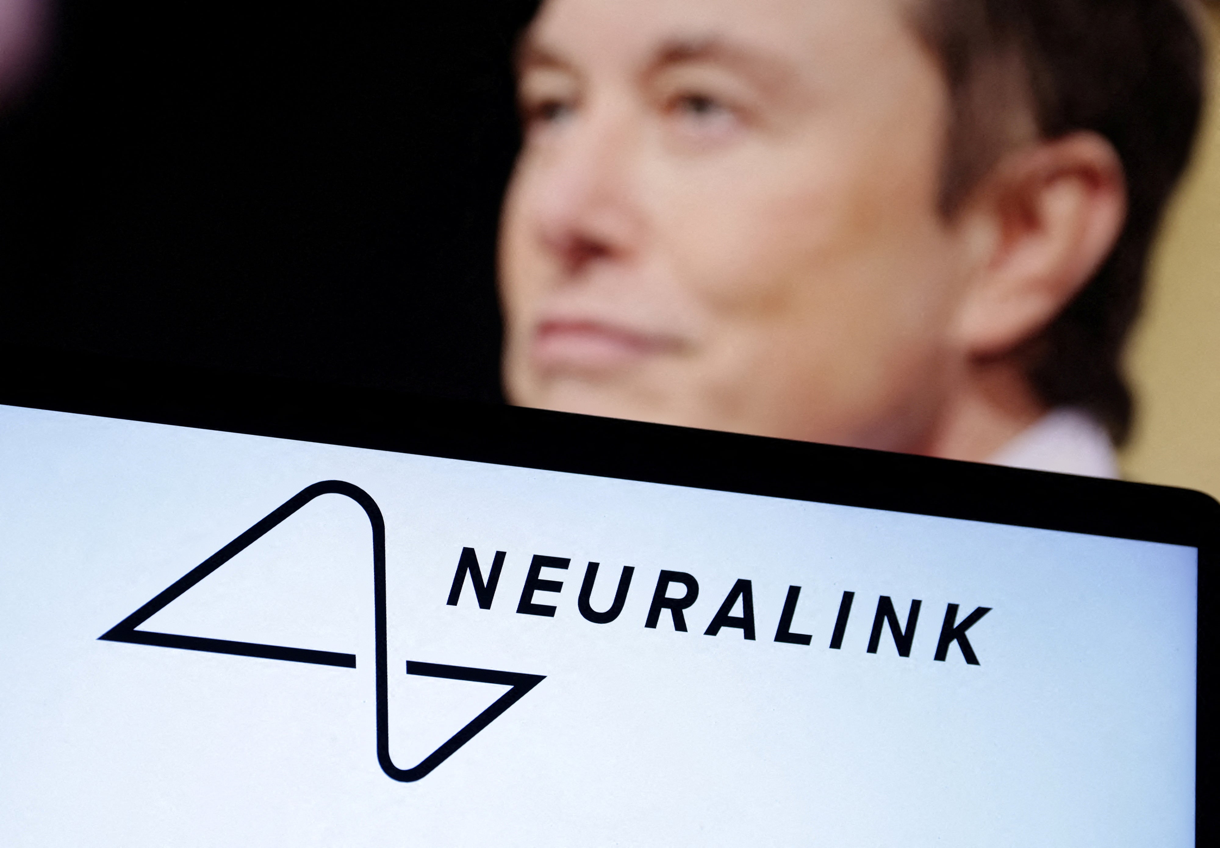 Elon Musk says a third person has received an implant from his brain-computer interface company Neuralink
