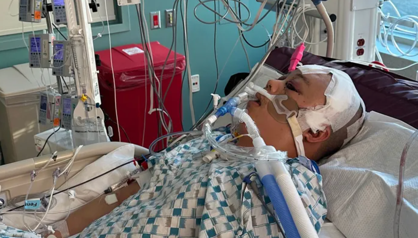 Run Hua Kuang is on life support after being shot in the head while napping in his home