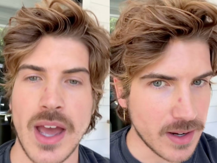 YouTuber Joey Graceffa says he’s been diagnosed with skin cancer