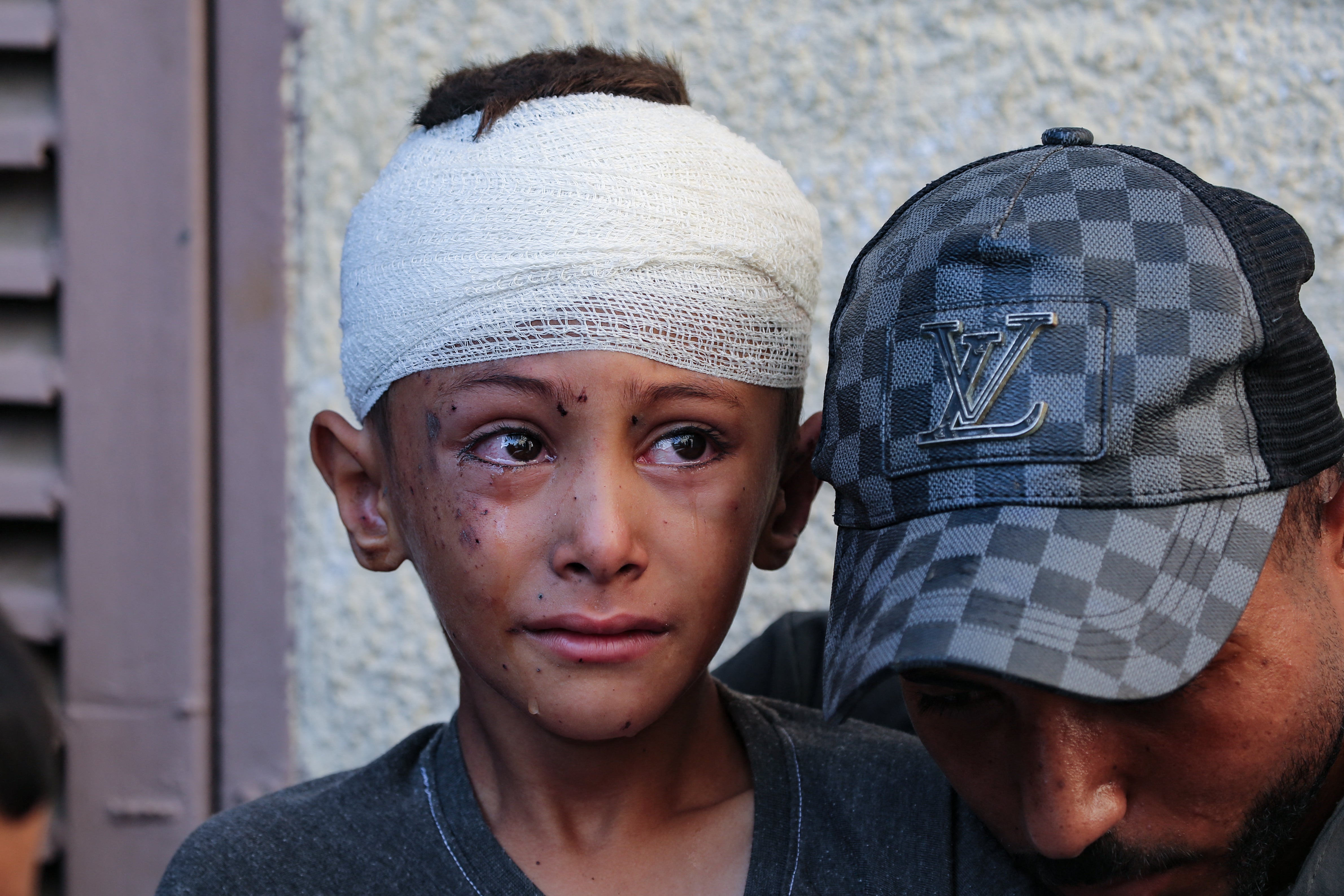 An injured child in the yard of the Al-Aqsa Martyrs hospital in Deir el-Balah on Saturday