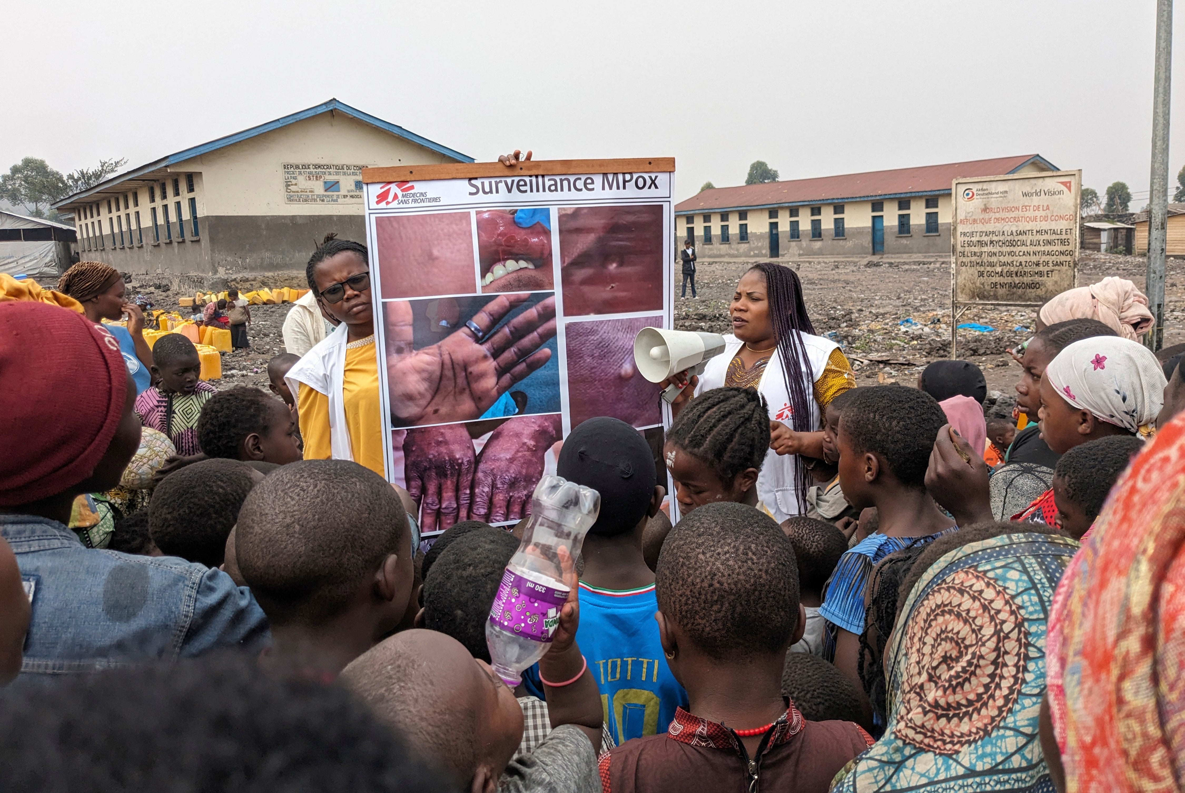 This photo supplied by MSF (Doctors Without Borders) dated 31 May 2023, shows health workers educating children on the symptoms of the mpox disease in Goma, Congo