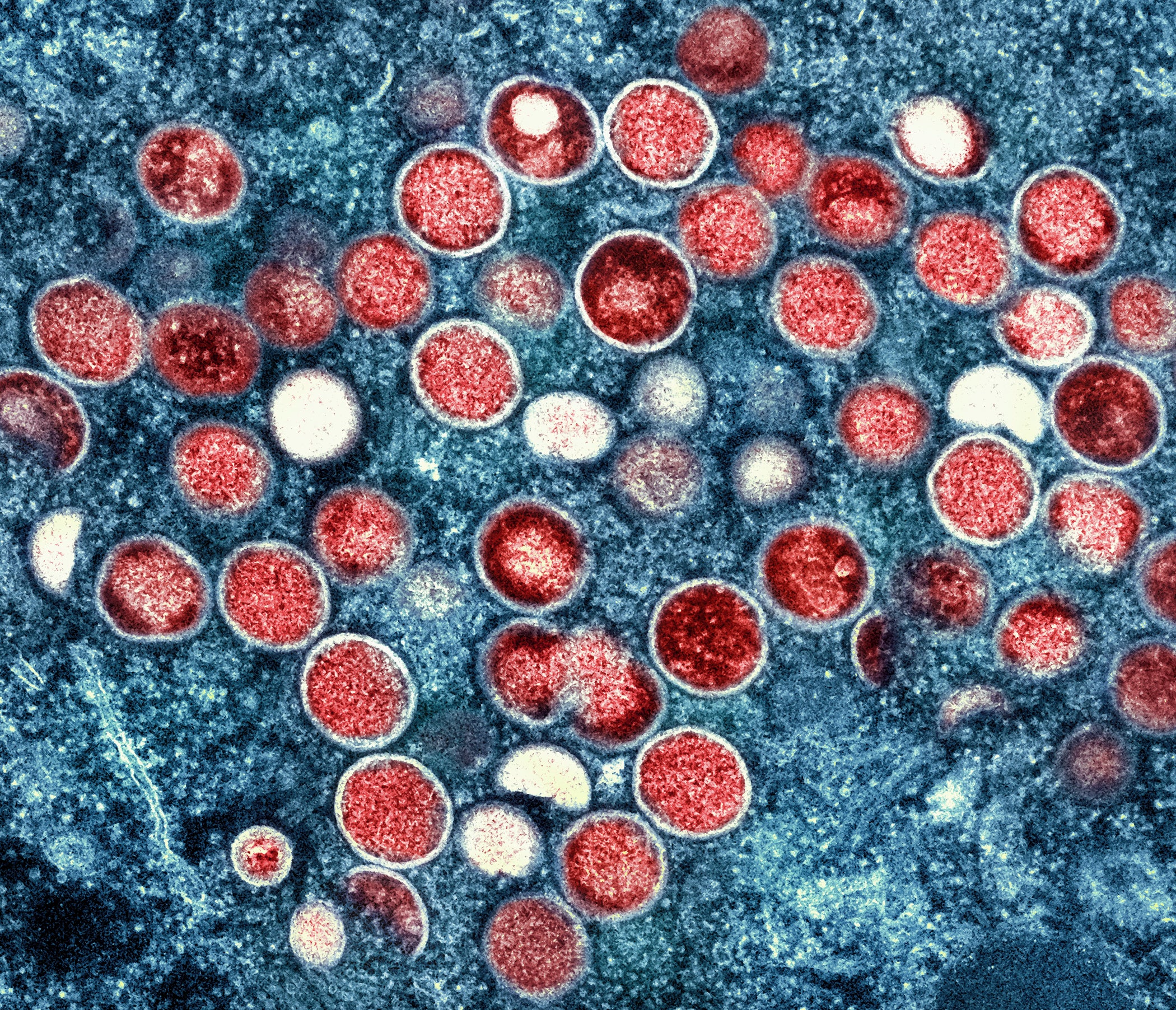 An electron micrograph of monkeypox particles found within an infected cell (NIAID via AP)