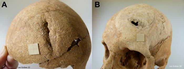 Skulls showing signs of violence