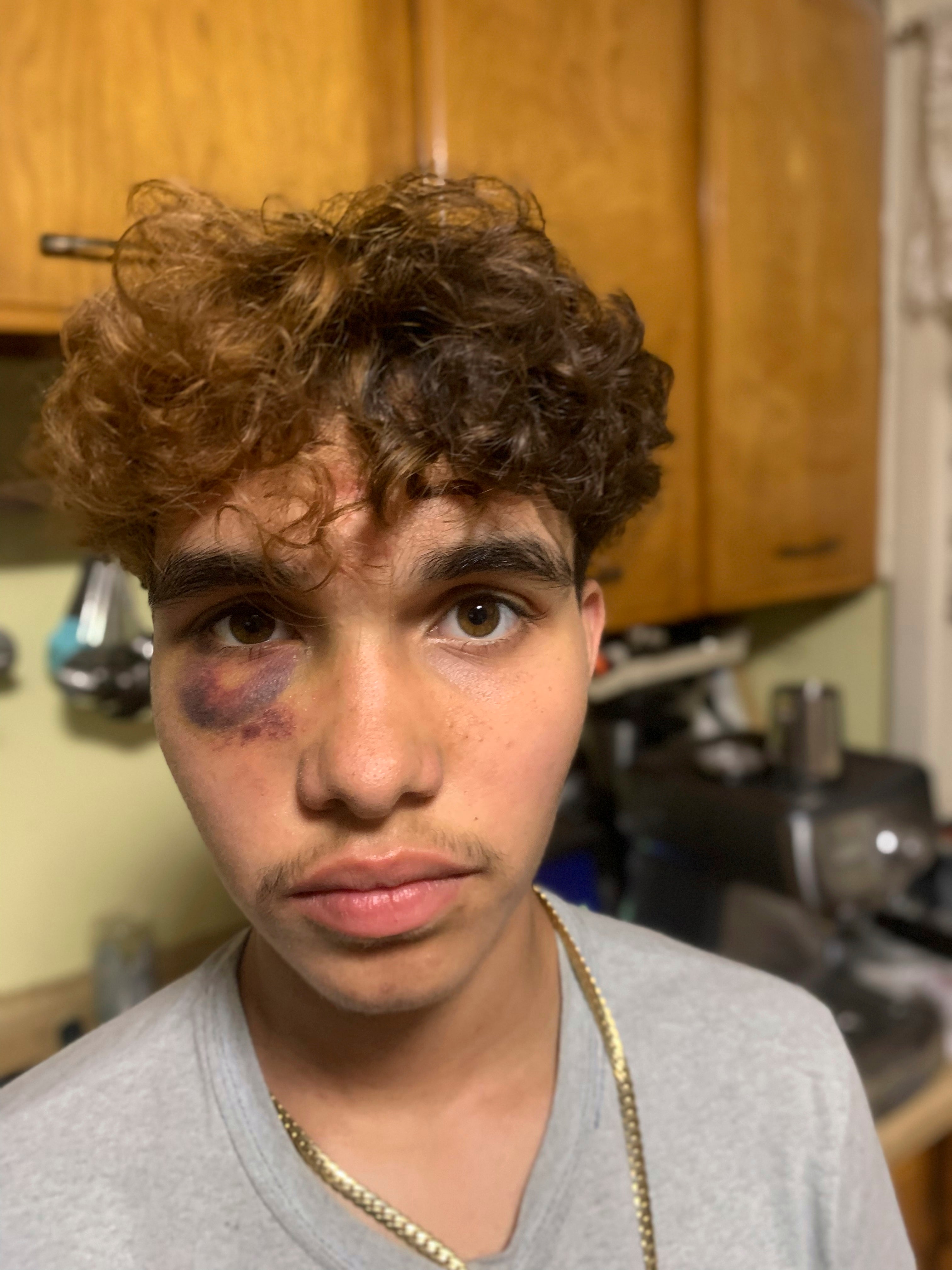 Transgender Teen Beating