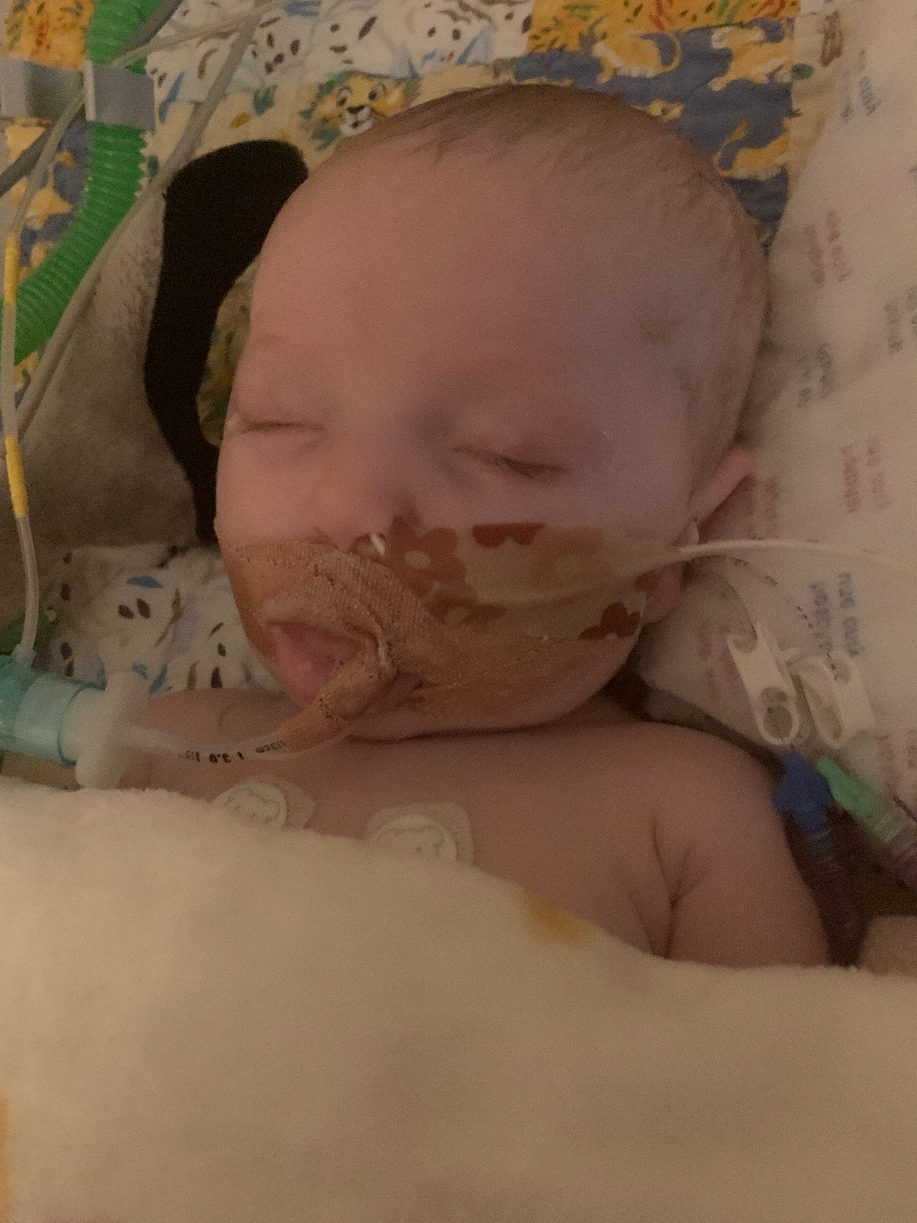 Freya had a cardiac arrest at 10 weeks old