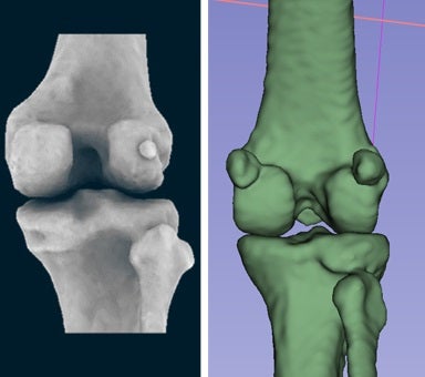 A comparison of the back of a human (left) and macaque knee, which shows the medial and lateral fabella on the macaque and lateral fabella of a human