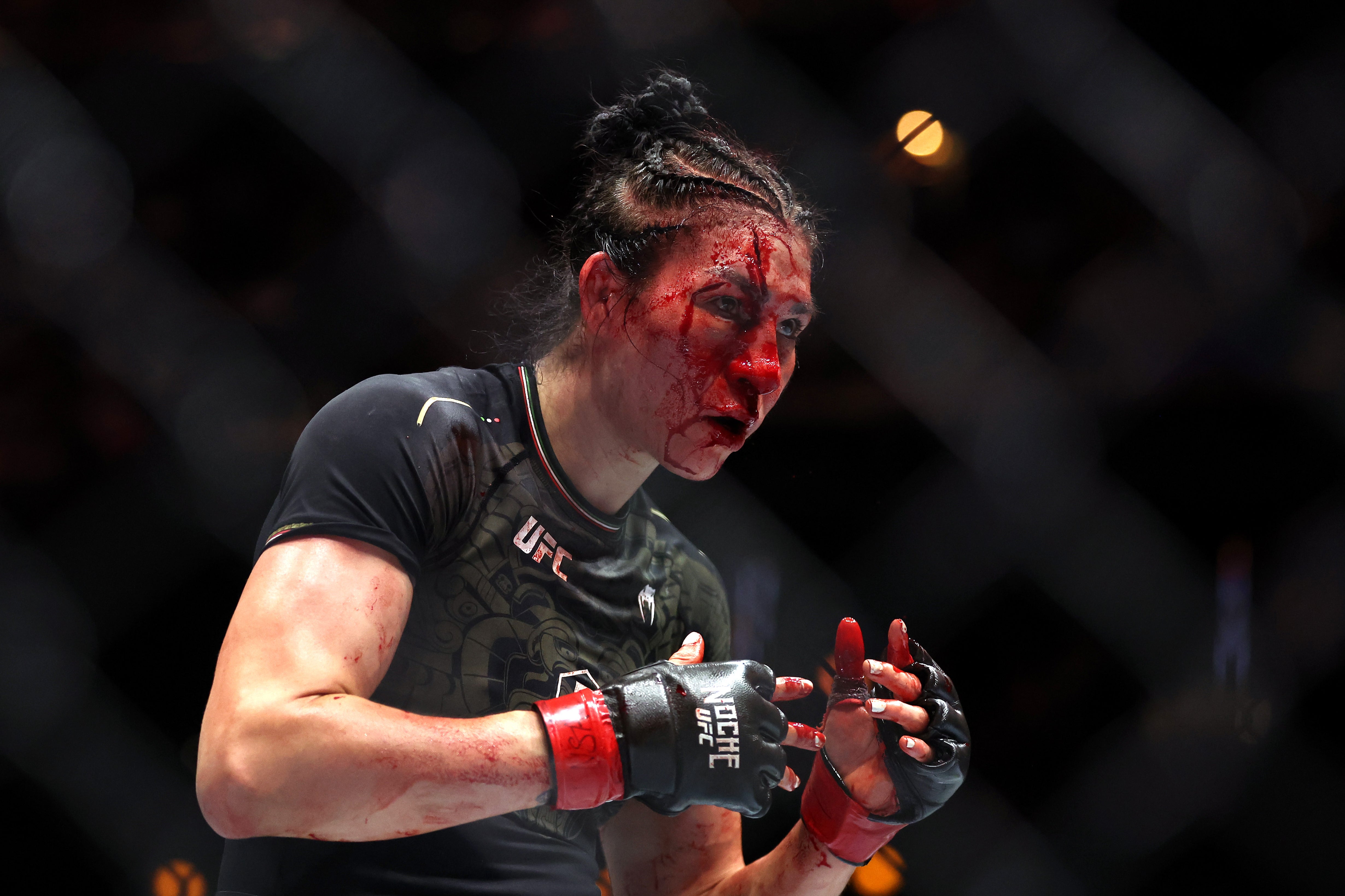 Irene Aldana sports a gruesome cut on her head in her loss to Norma Dumont