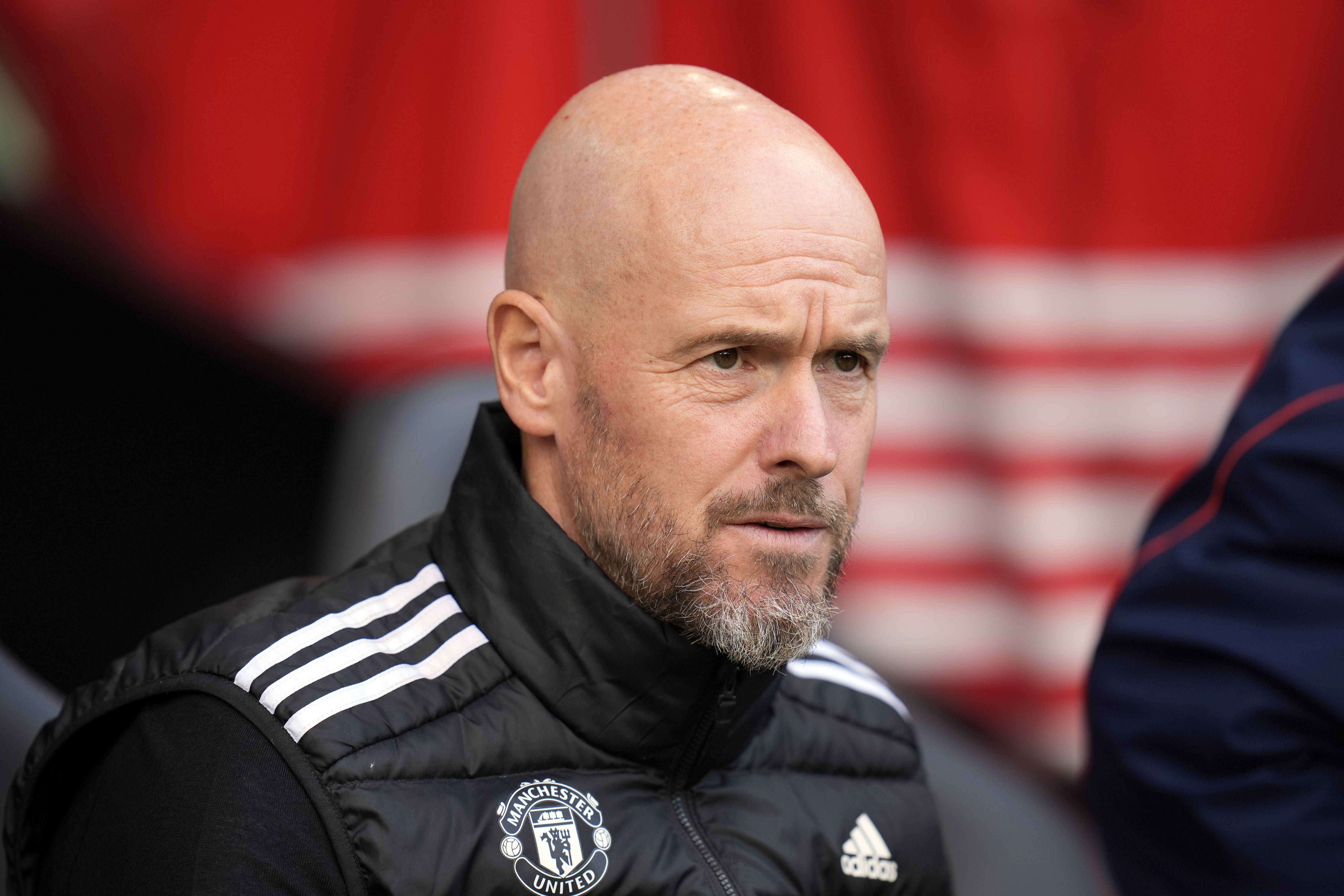 Erik ten Hag believes that it is an inevitability that top players will suffer injuries as they play too many games