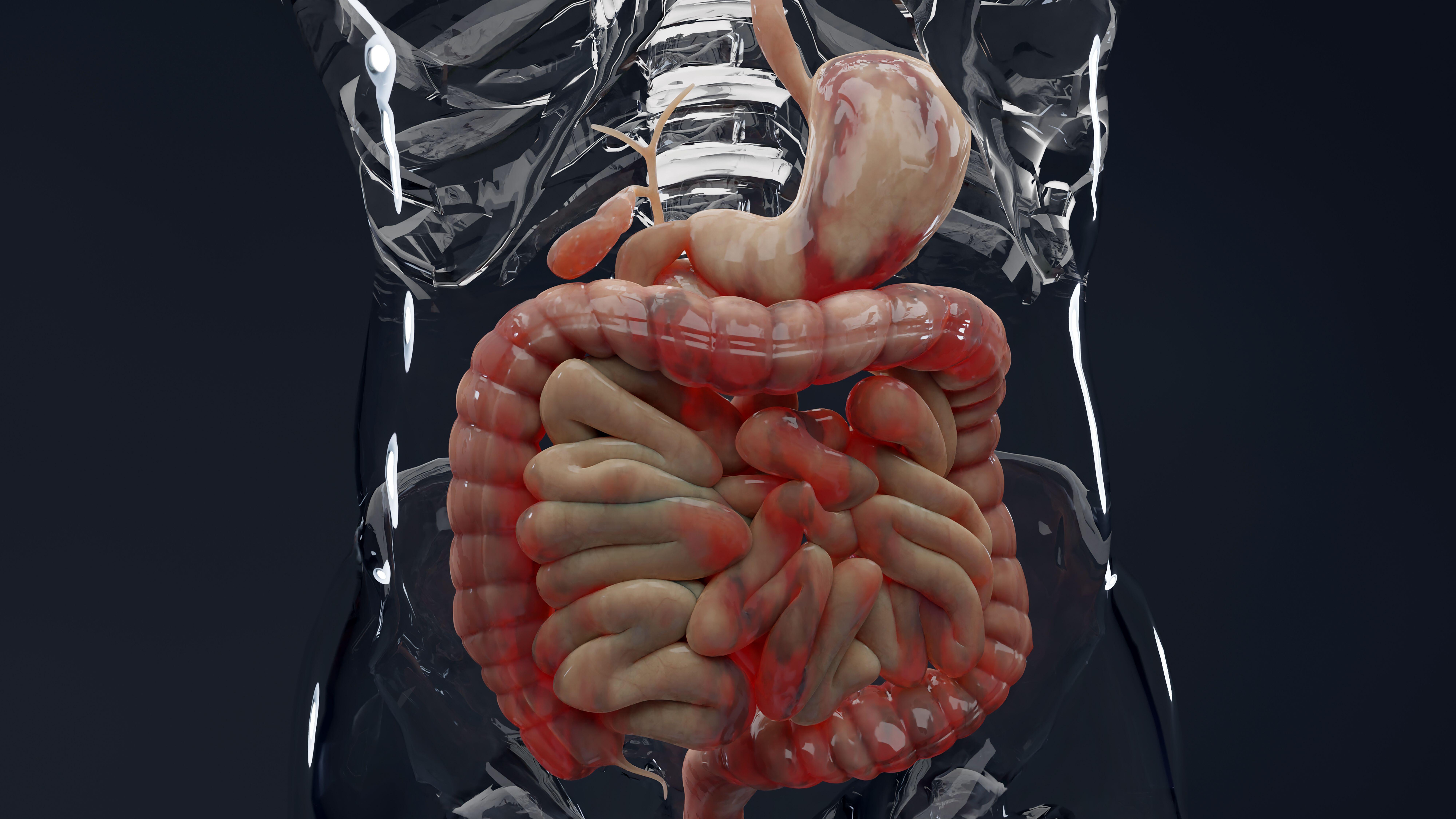 Some people with Crohn’s have an inflamed large intestine (Alamy/PA)