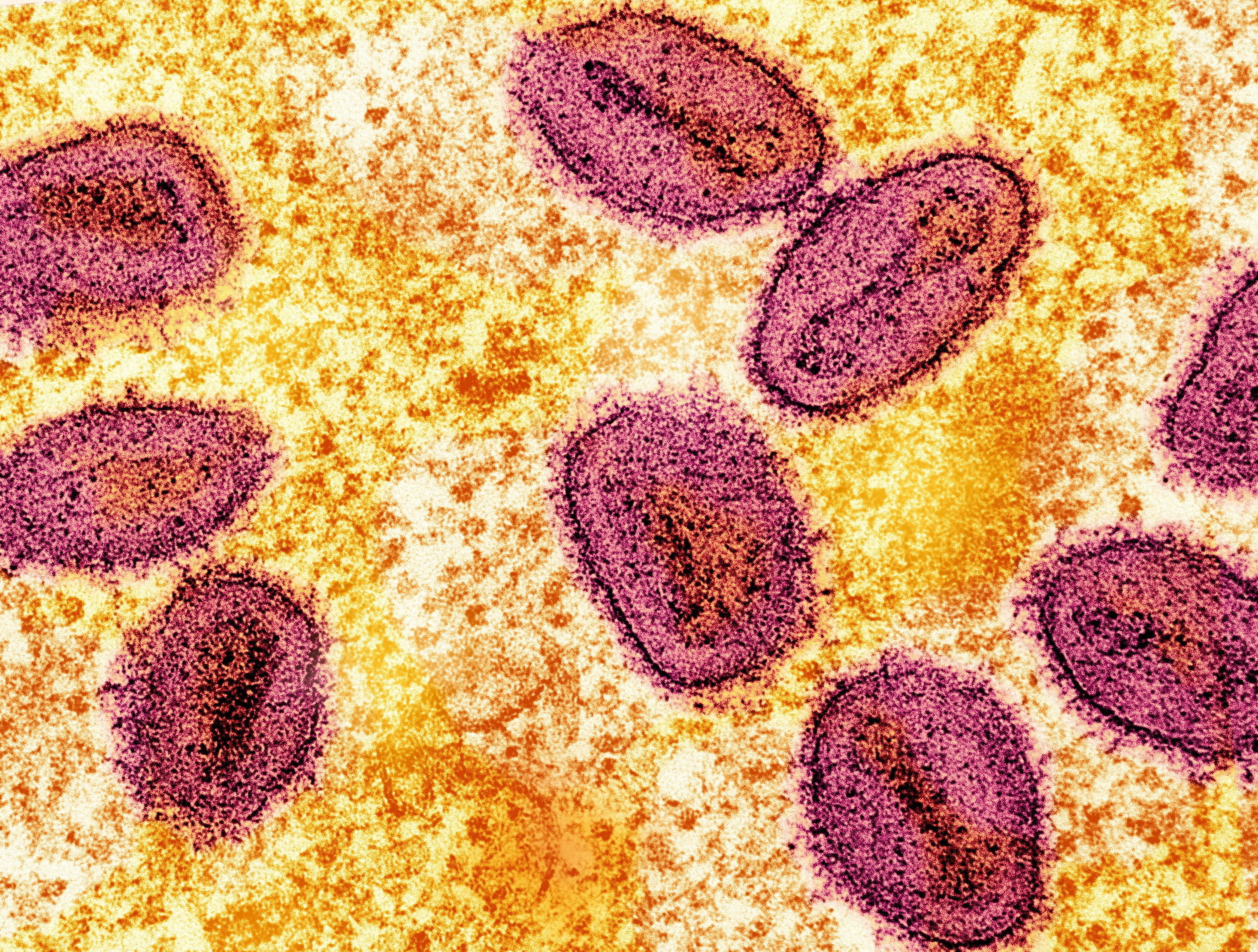 File: Colorized transmission electron micrograph of mpox virus particles captured at the NIAID Integrated Research Facility in Fort Detrick