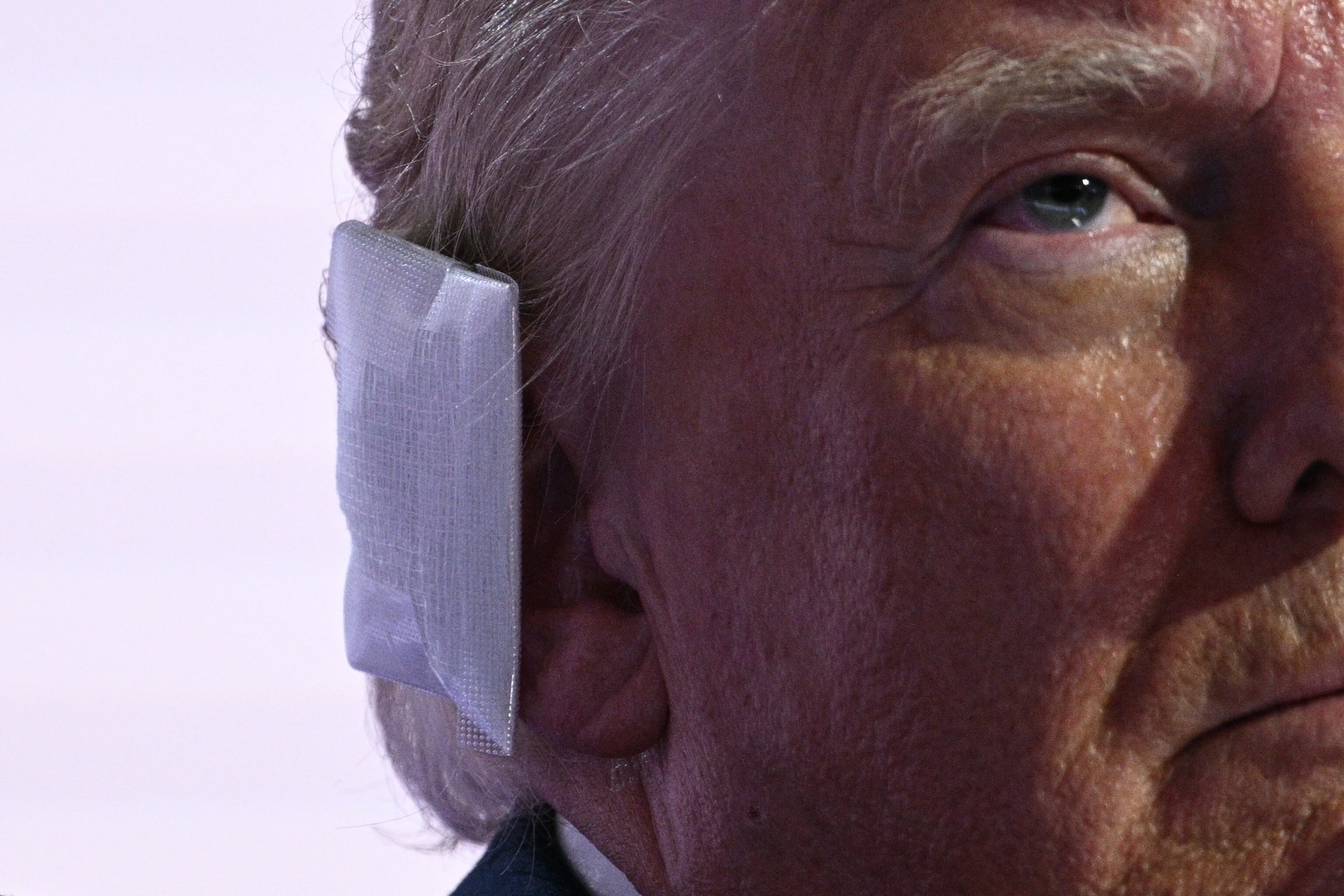 Donald Trump wears a bandage on his ear after surviving an assassination attempt